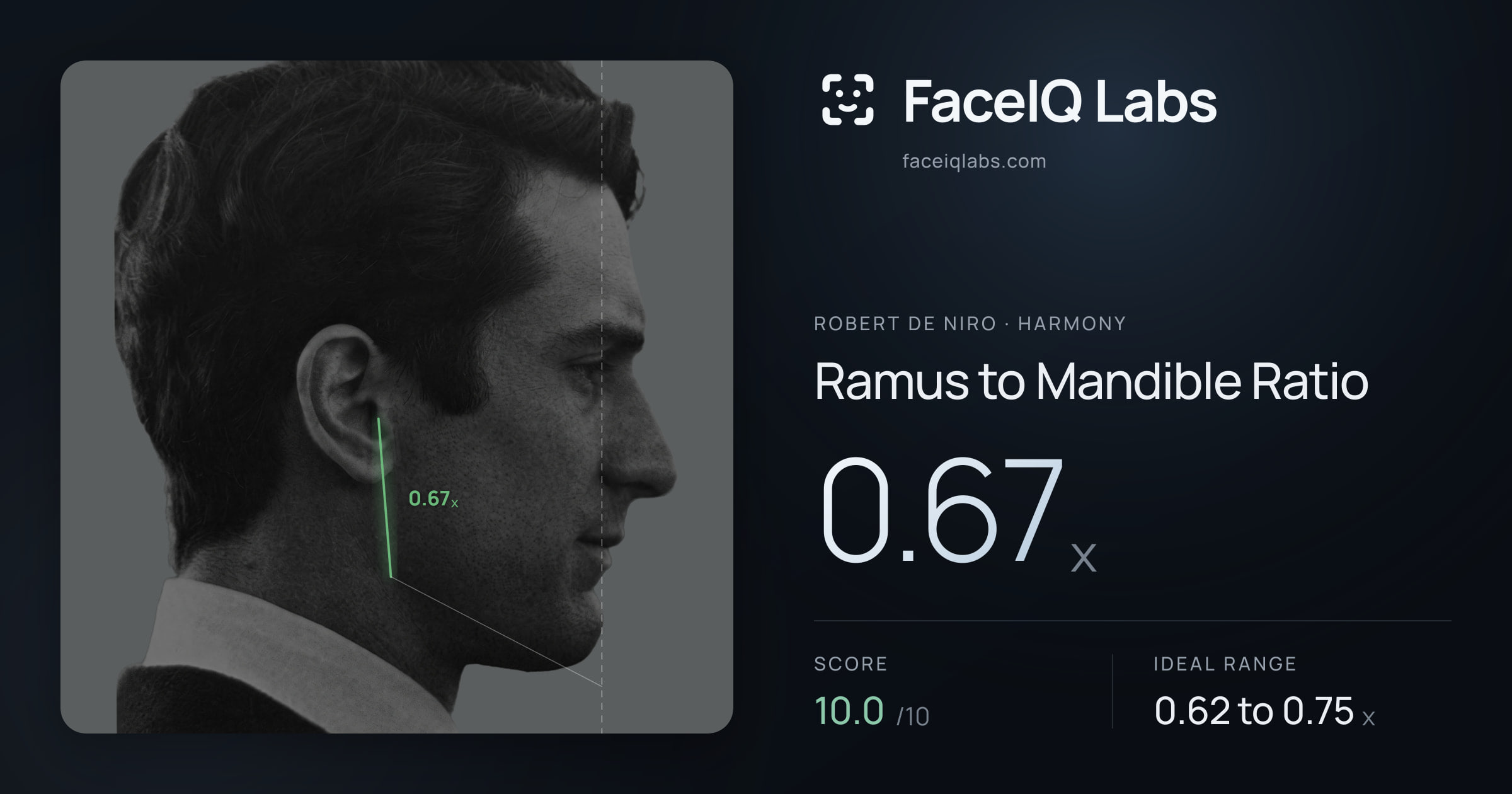 Robert De Niro Ramus to Mandible Ratio: 0.67x, drawn on the photo