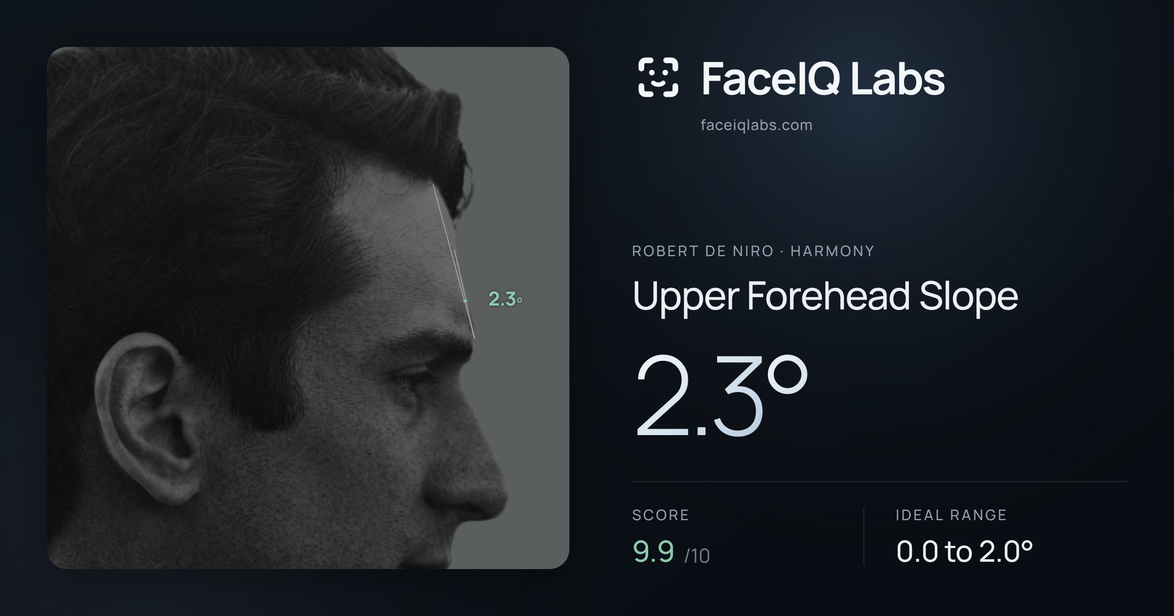 Robert De Niro Upper Forehead Slope: 2.3°, drawn on the photo