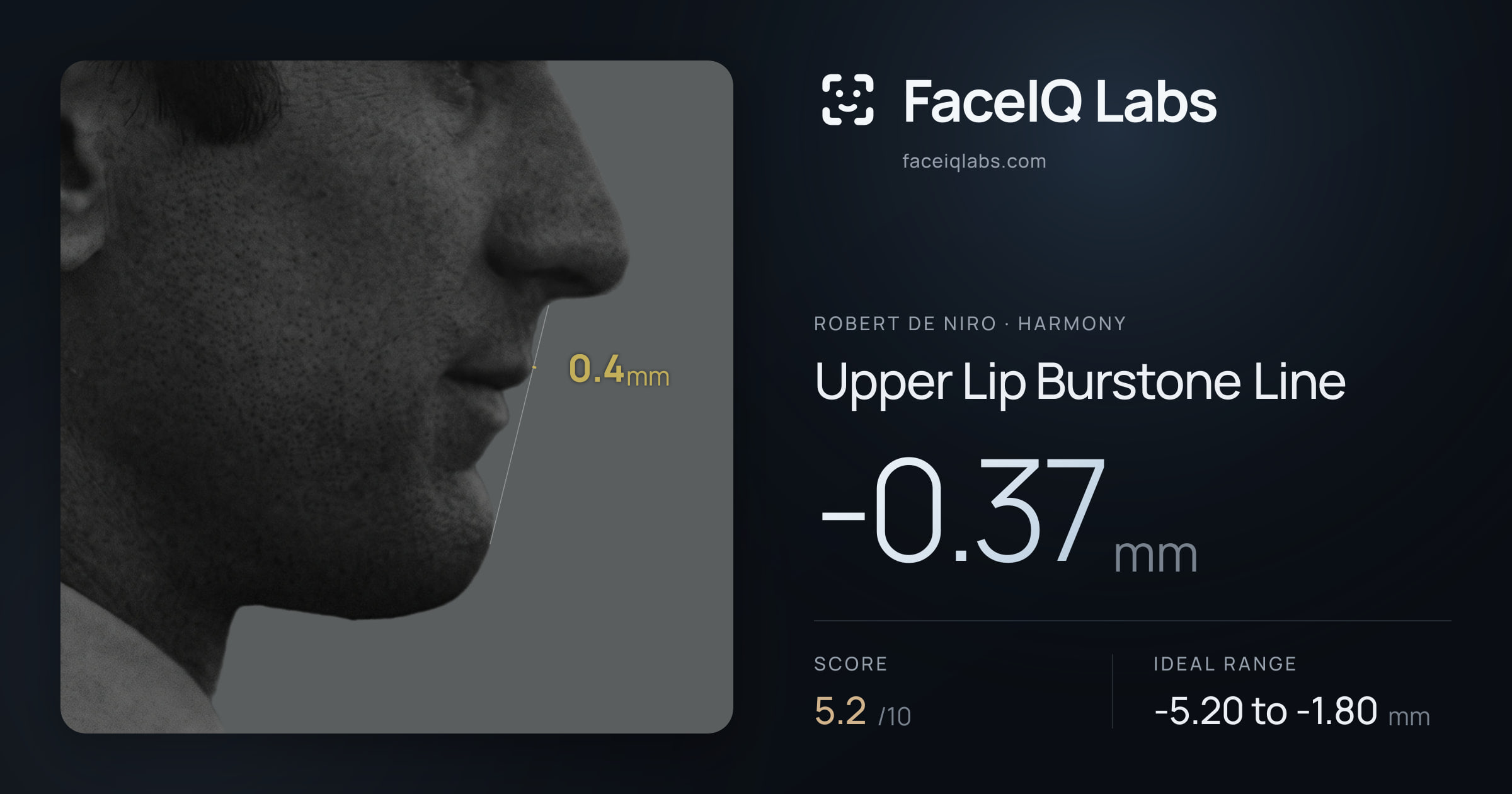 Robert De Niro Upper Lip Burstone Line: -0.37mm, drawn on the photo