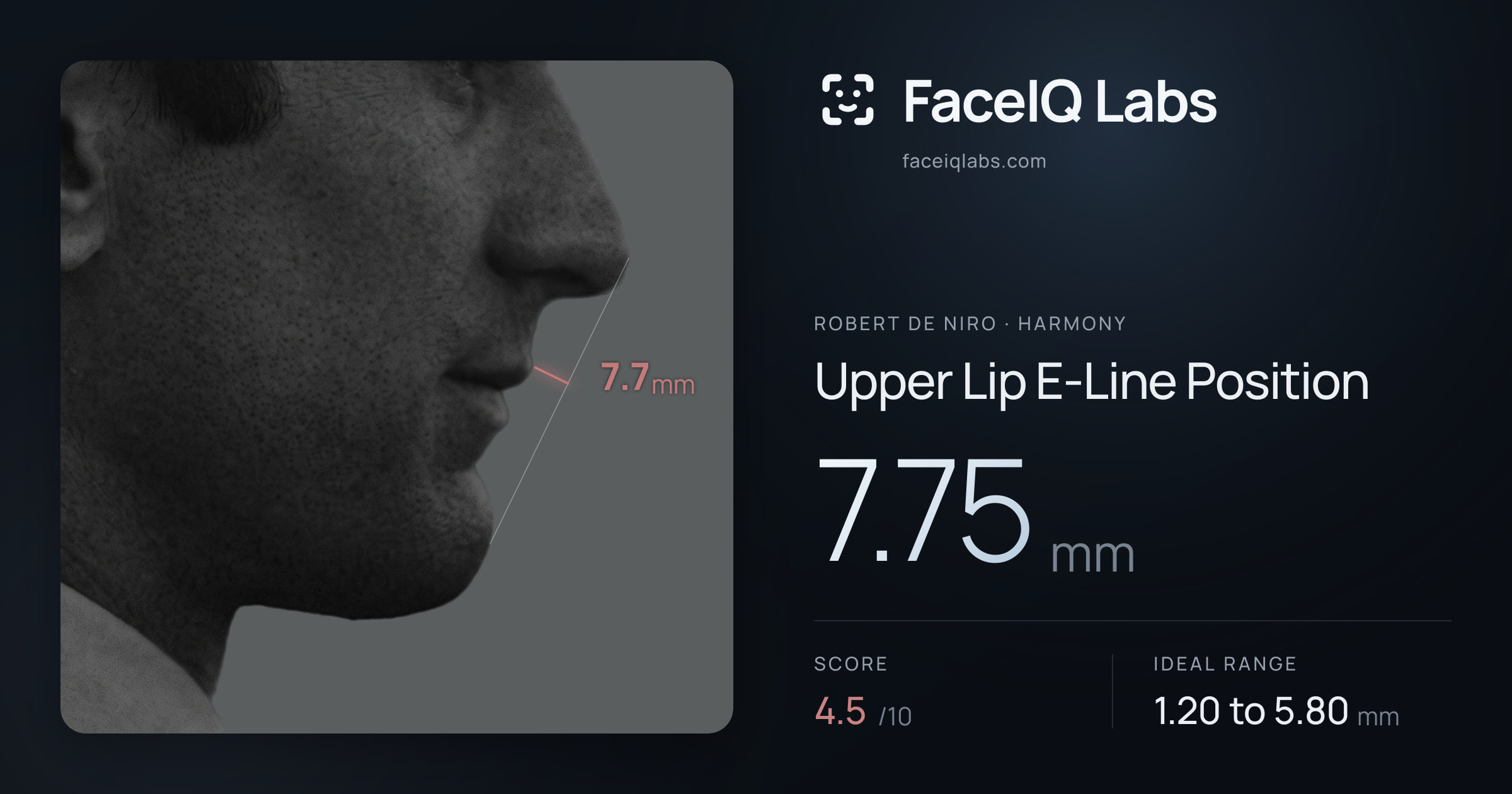 Robert De Niro Upper Lip E-Line Position: 7.75mm, drawn on the photo