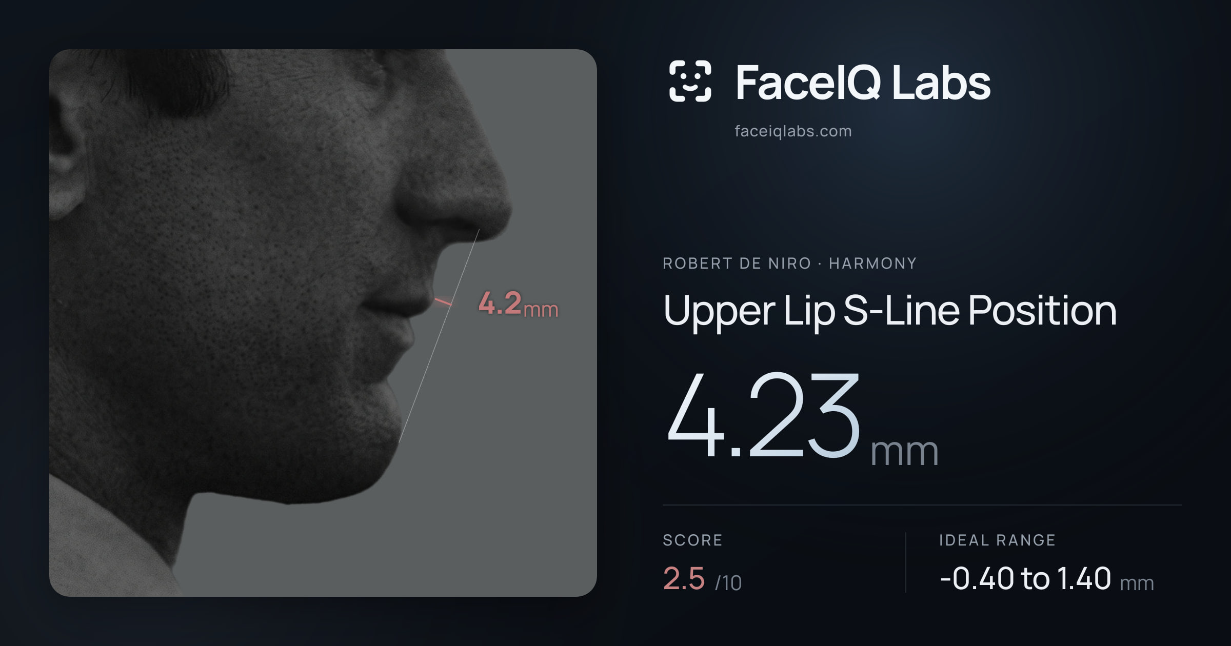 Robert De Niro Upper Lip S-Line Position: 4.23mm, drawn on the photo