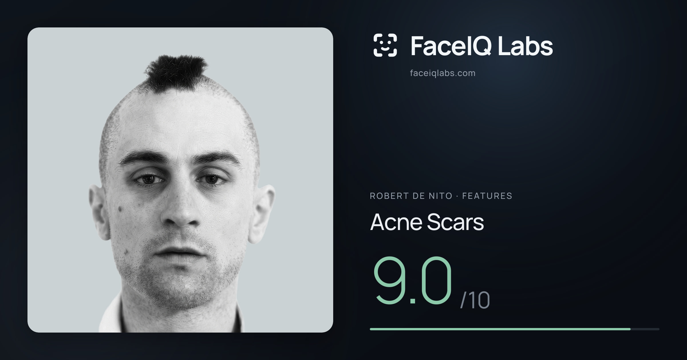 Robert De Nito Acne Scars: 9.0/10, drawn on the photo