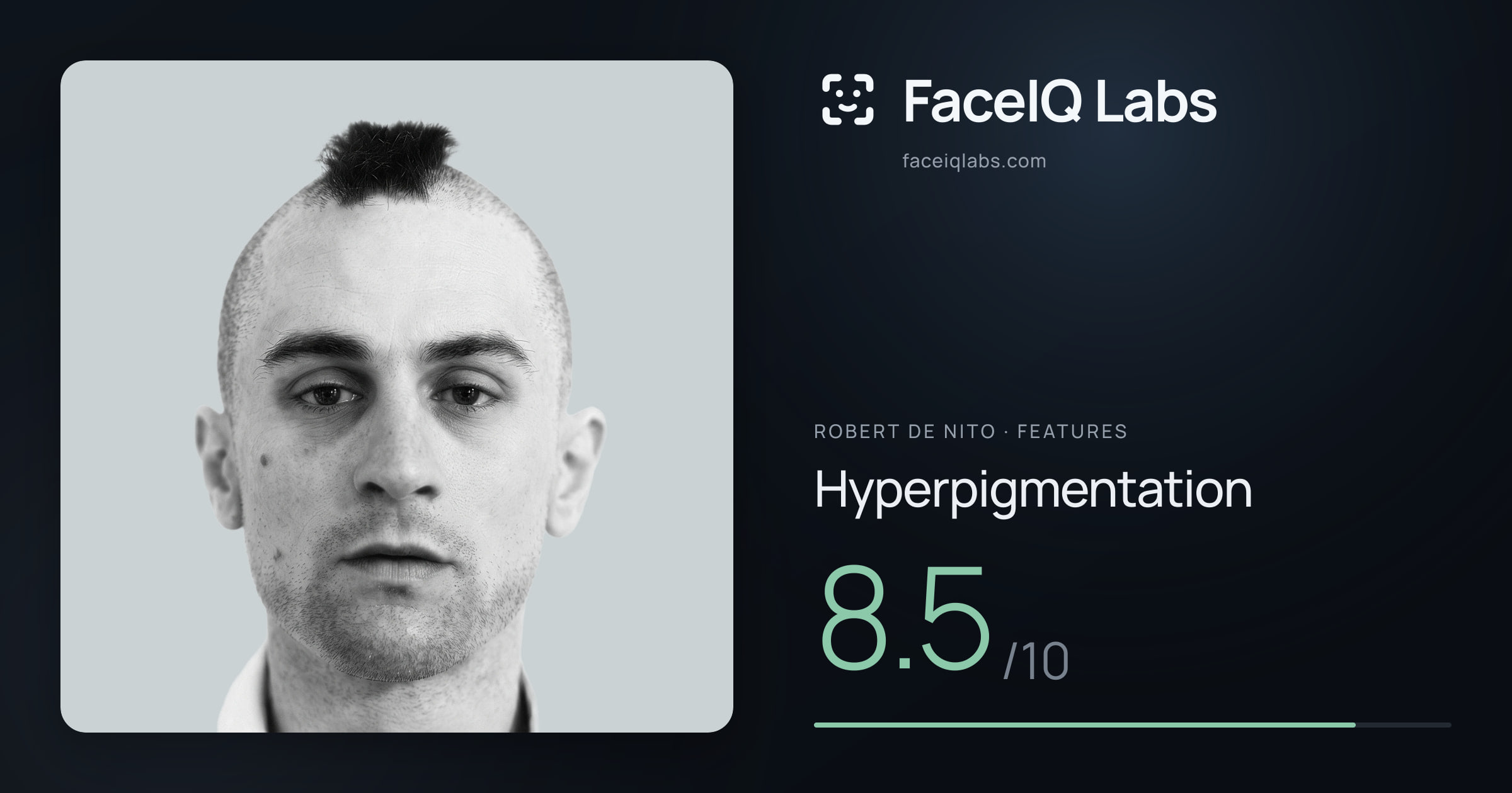 Robert De Nito Hyperpigmentation: 8.5/10, drawn on the photo