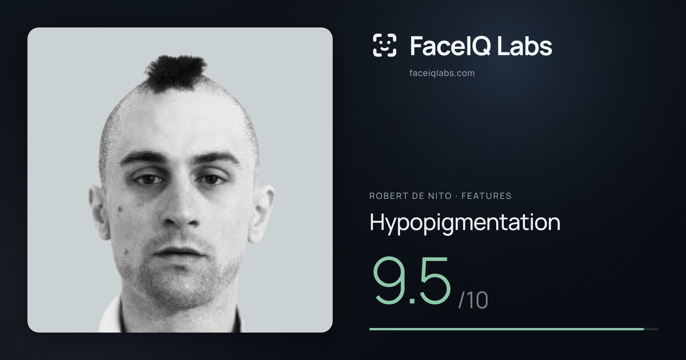 Robert De Nito Hypopigmentation: 9.5/10, drawn on the photo