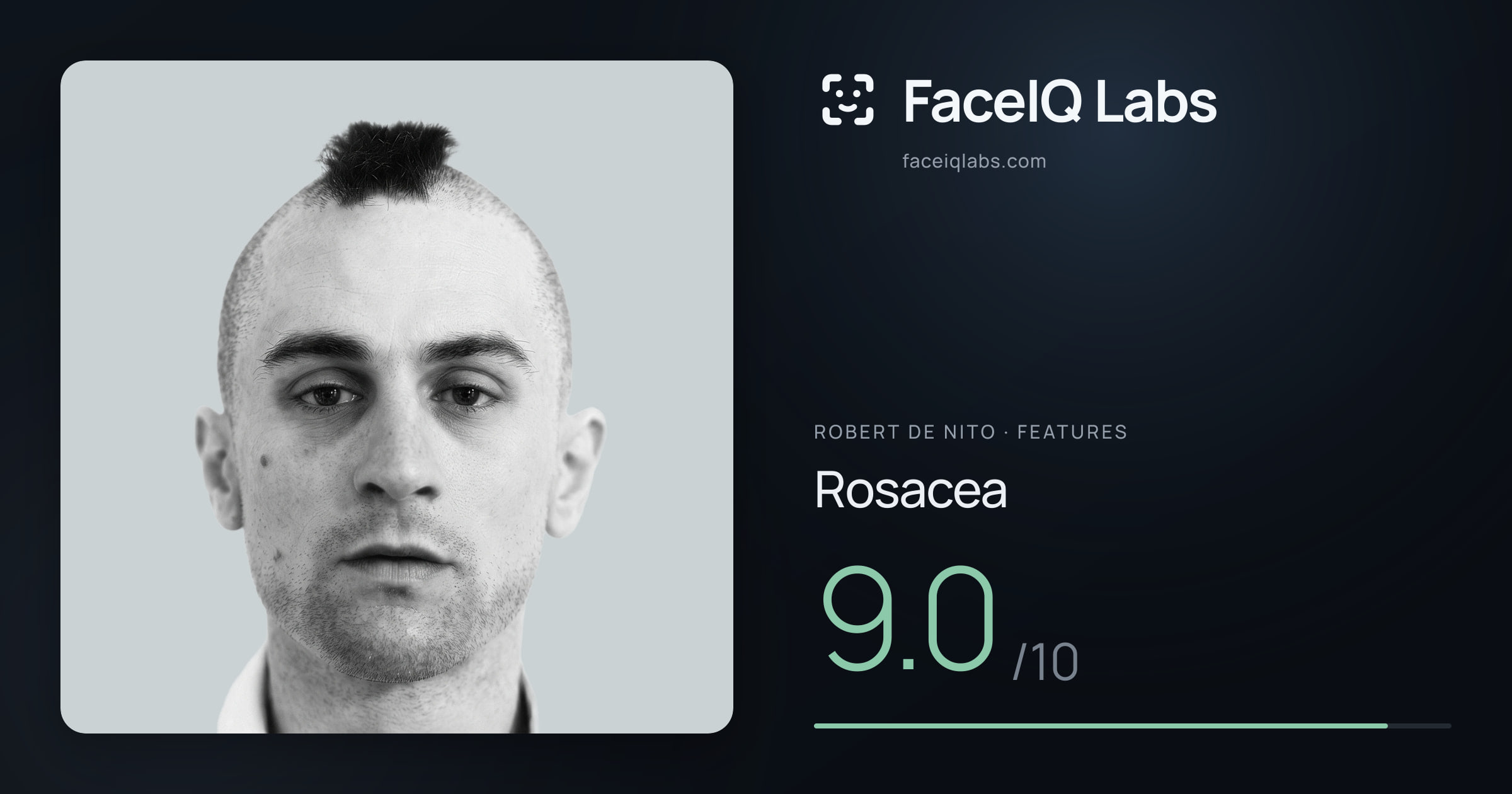 Robert De Nito Rosacea: 9.0/10, drawn on the photo