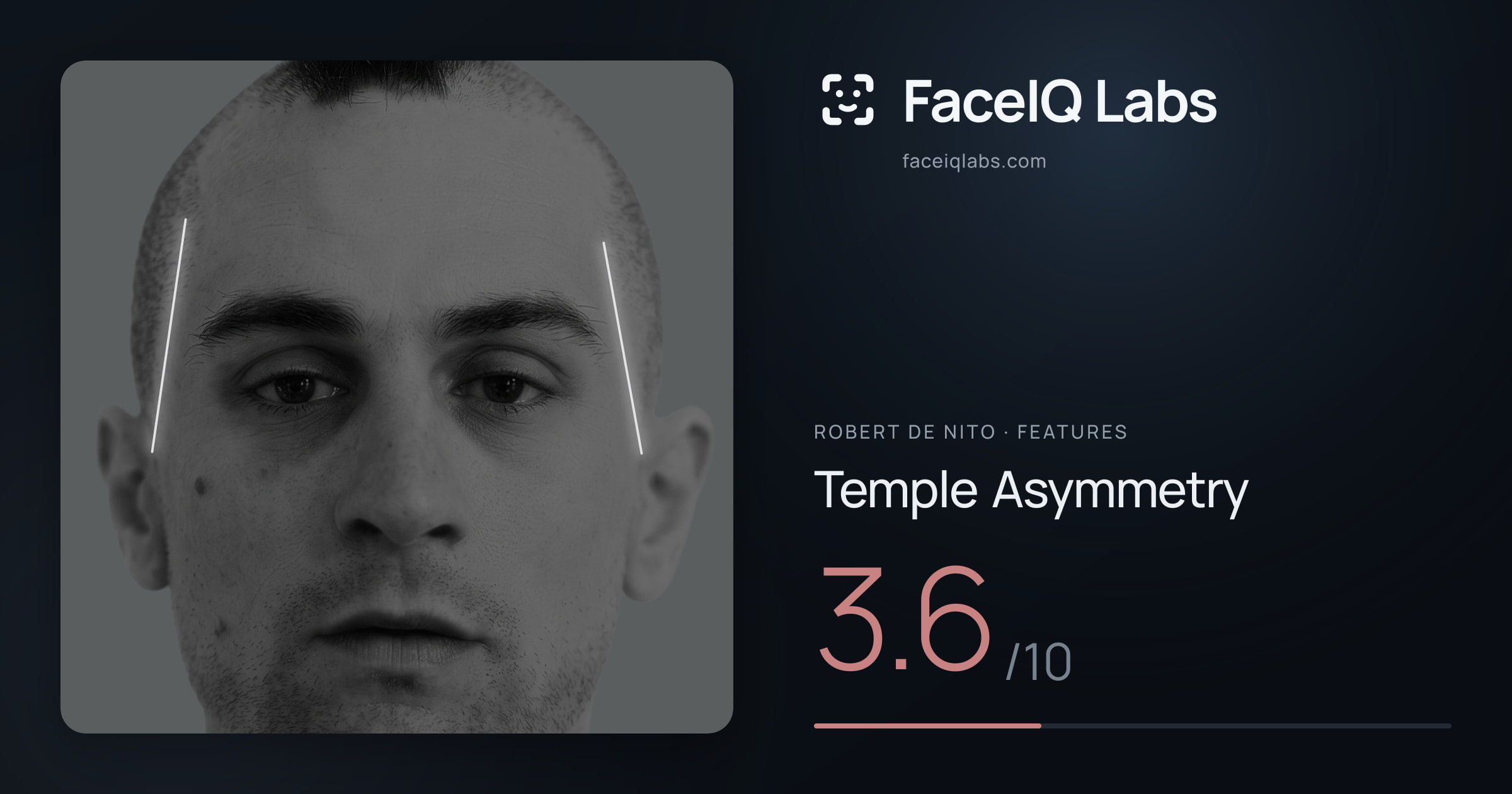 Robert De Nito Temple Asymmetry: 3.6/10, drawn on the photo