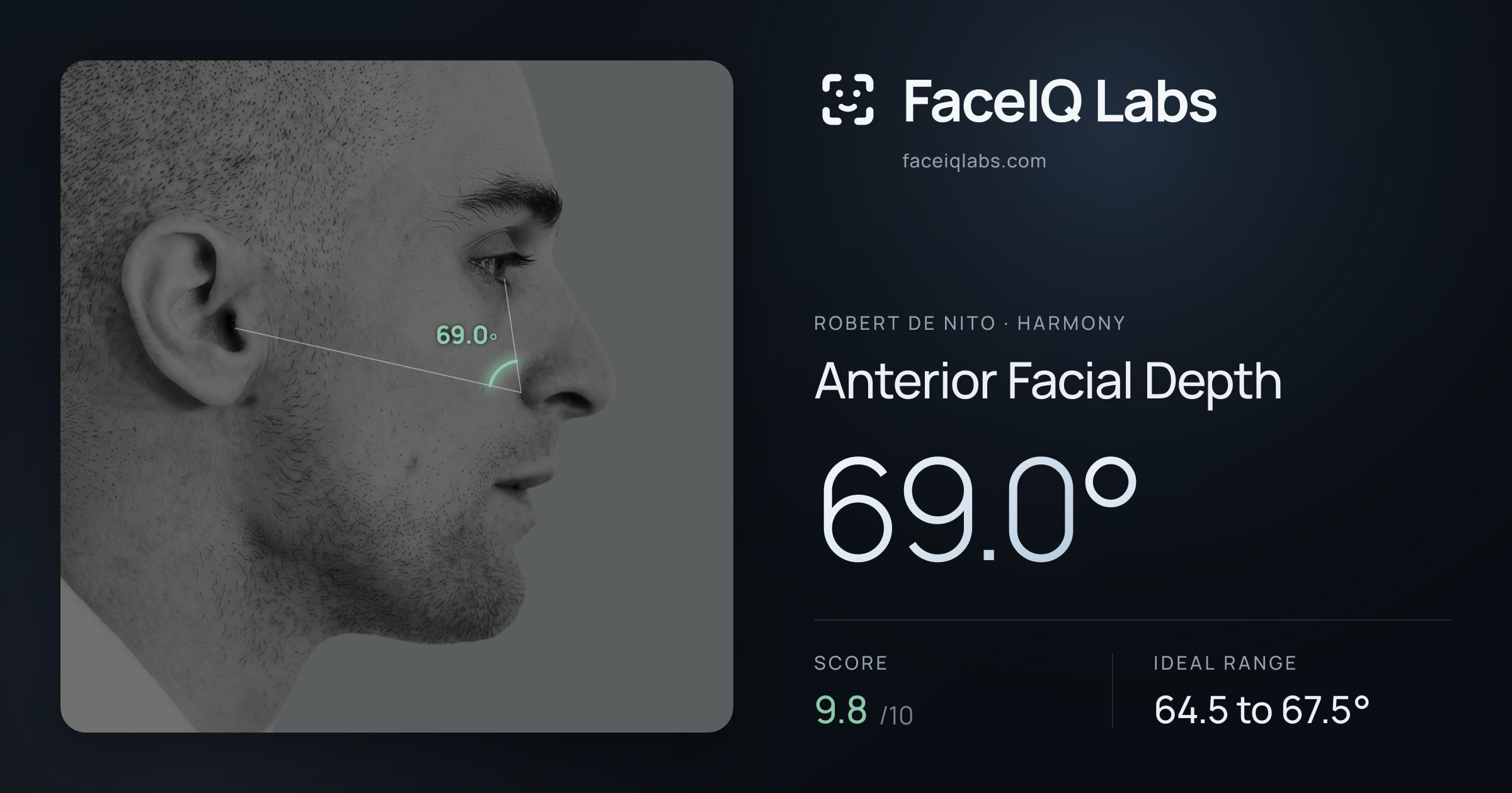 Robert De Nito Anterior Facial Depth: 69.0°, drawn on the photo