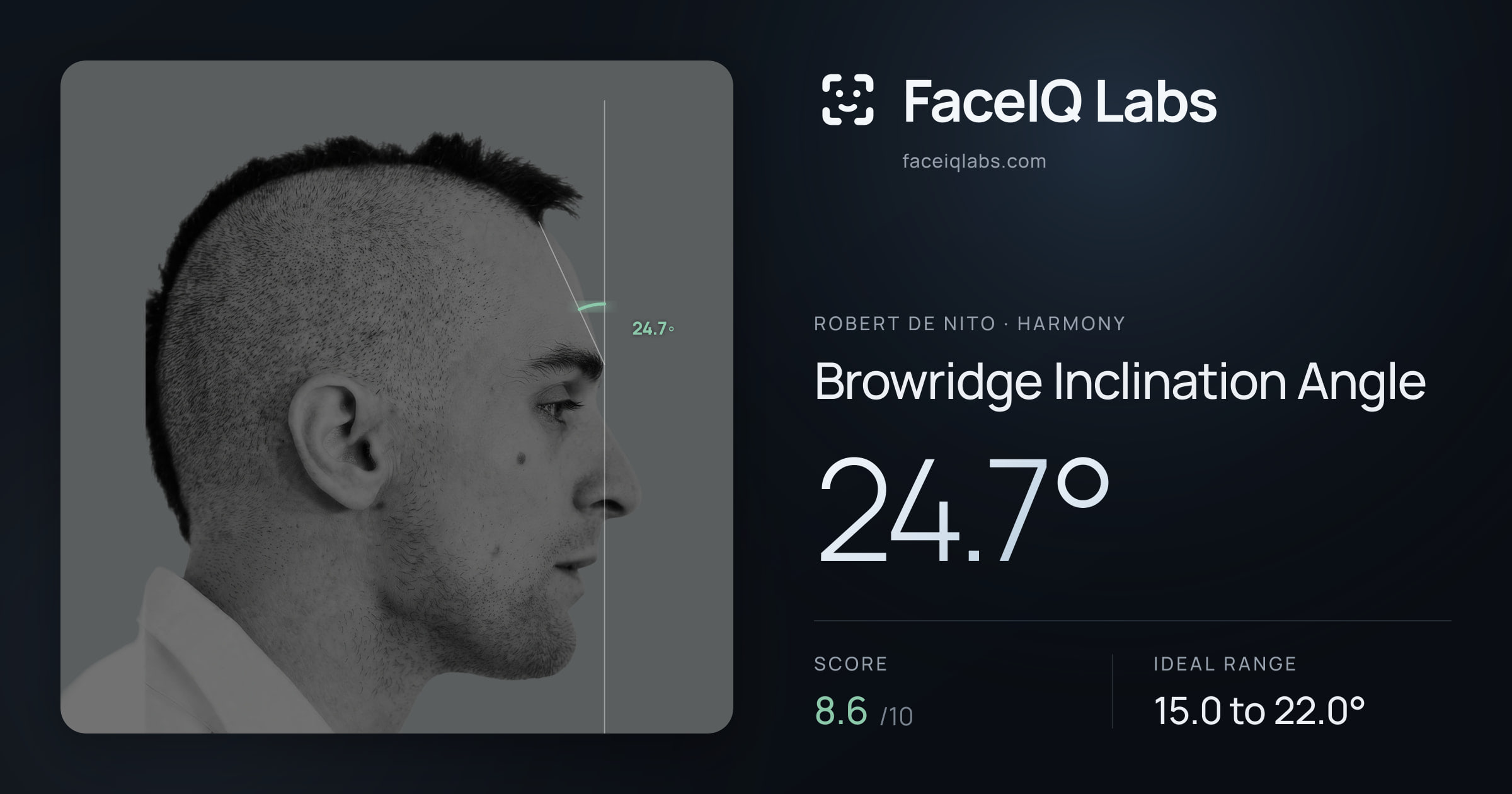 Robert De Nito Browridge Inclination Angle: 24.7°, drawn on the photo
