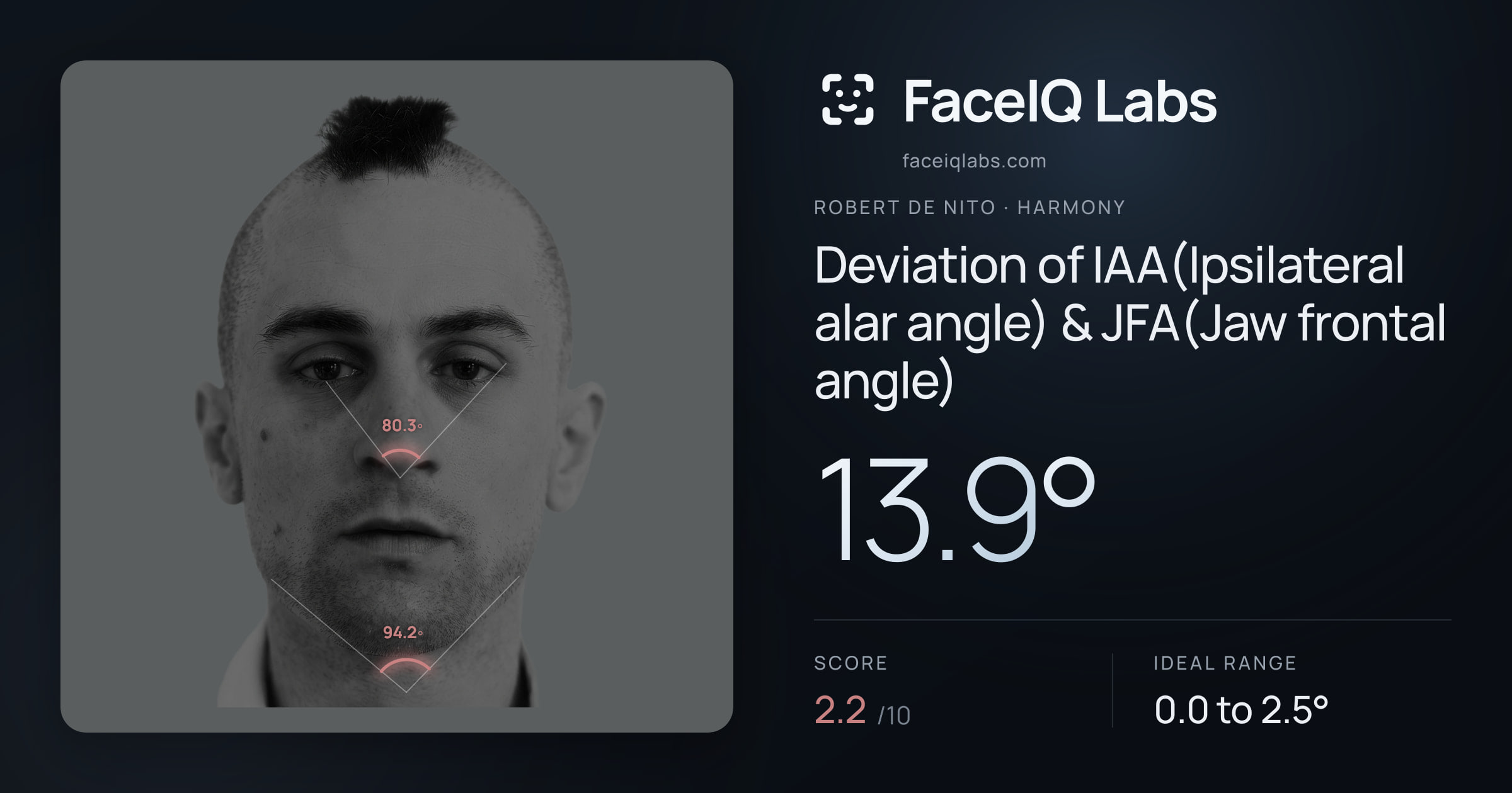 Robert De Nito Deviation of IAA(Ipsilateral alar angle) & JFA(Jaw frontal angle): 13.9°, drawn on the photo