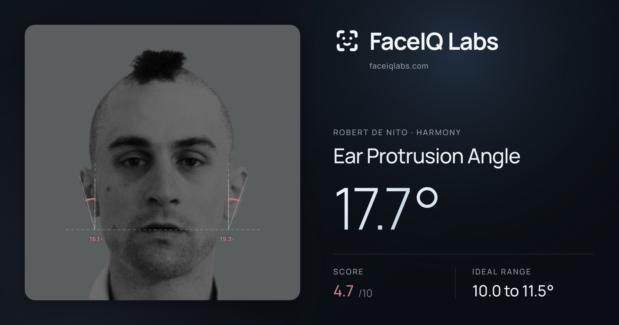 Robert De Nito Ear Protrusion Angle: 17.7°, drawn on the photo