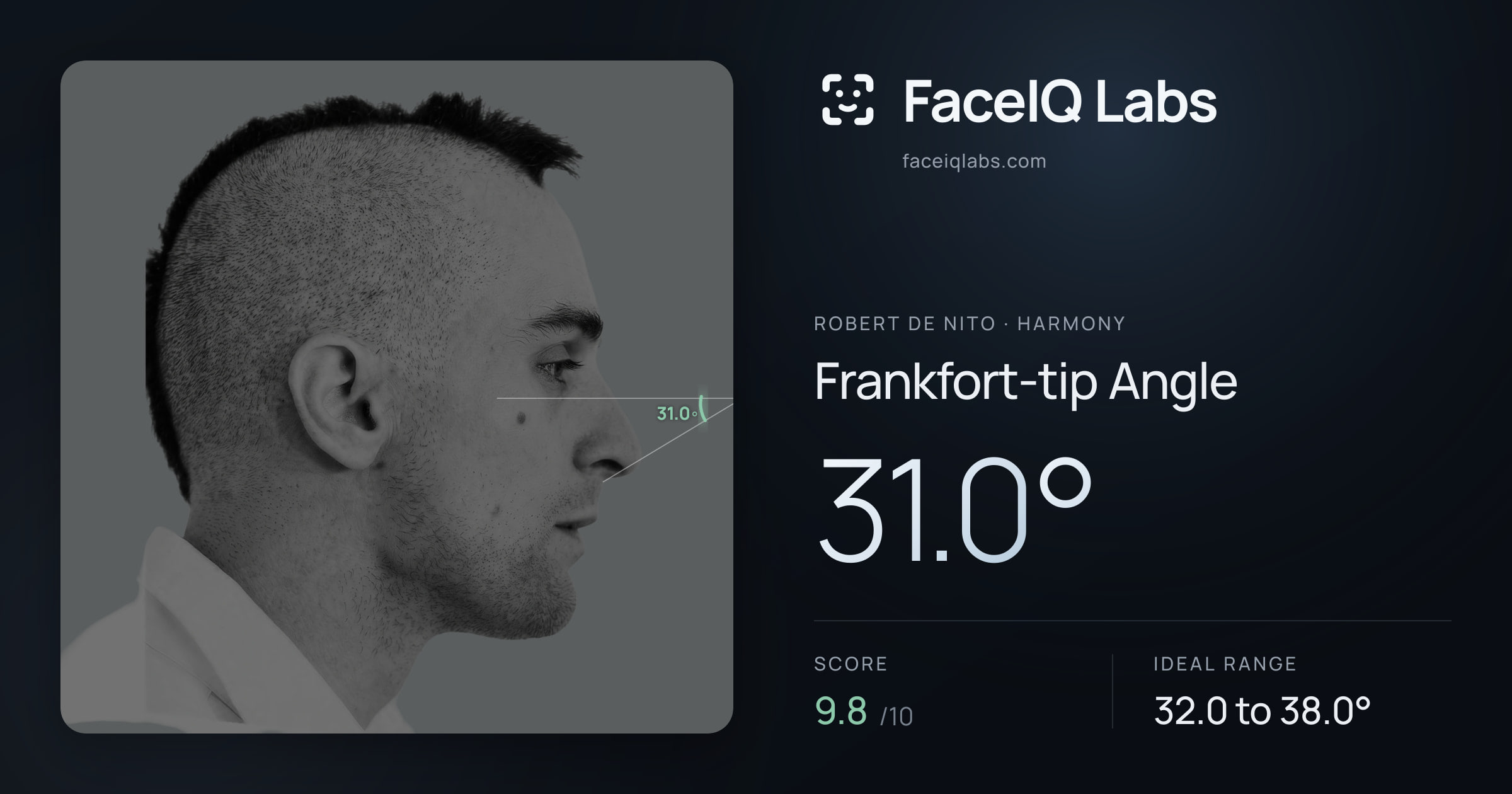 Robert De Nito Frankfort-tip Angle: 31.0°, drawn on the photo