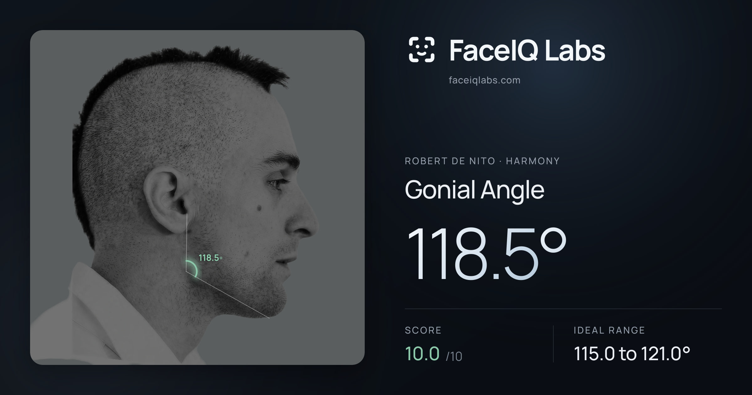 Robert De Nito Gonial Angle: 118.5°, drawn on the photo