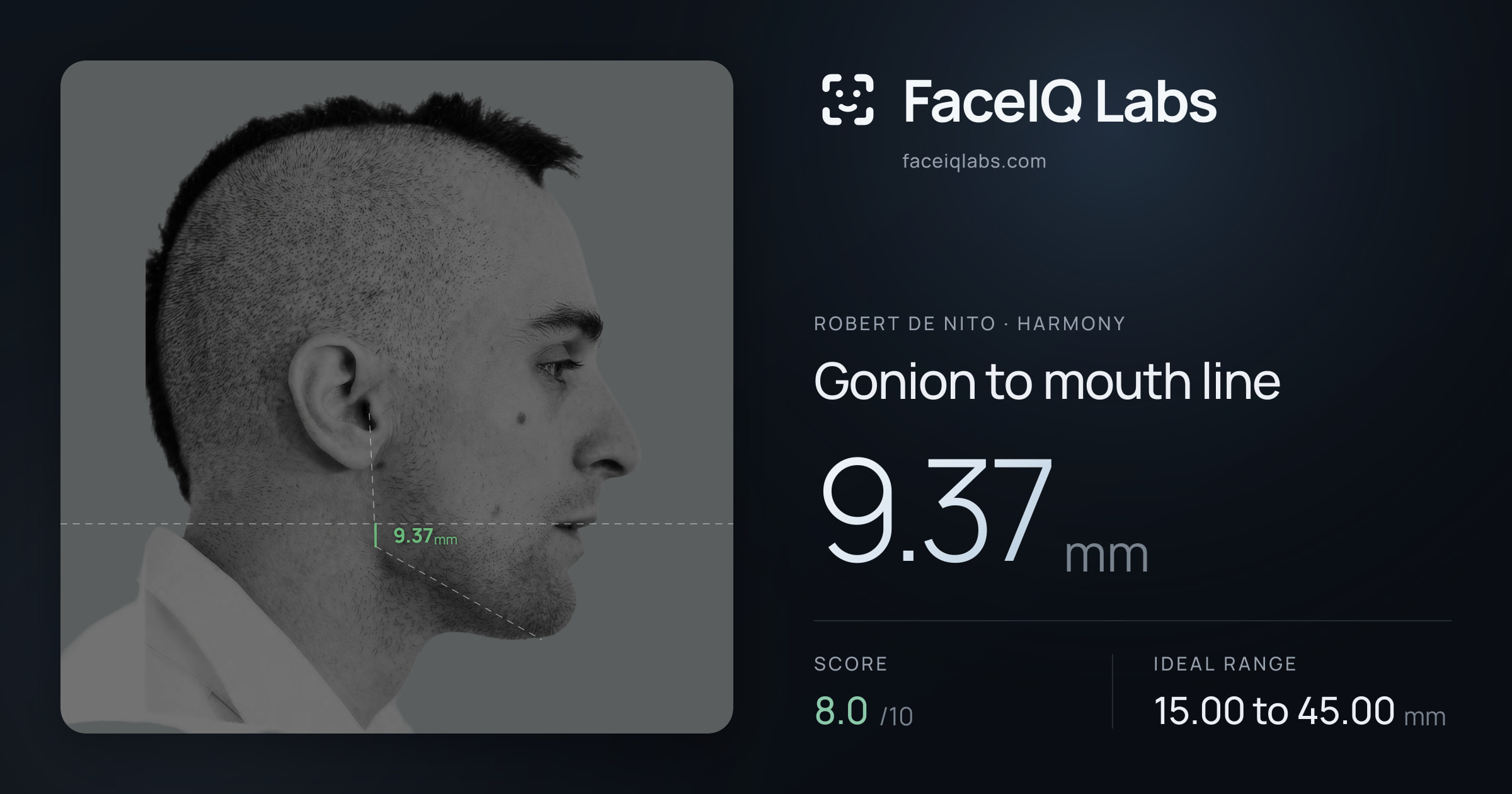 Robert De Nito Gonion to mouth line: 9.37mm, drawn on the photo