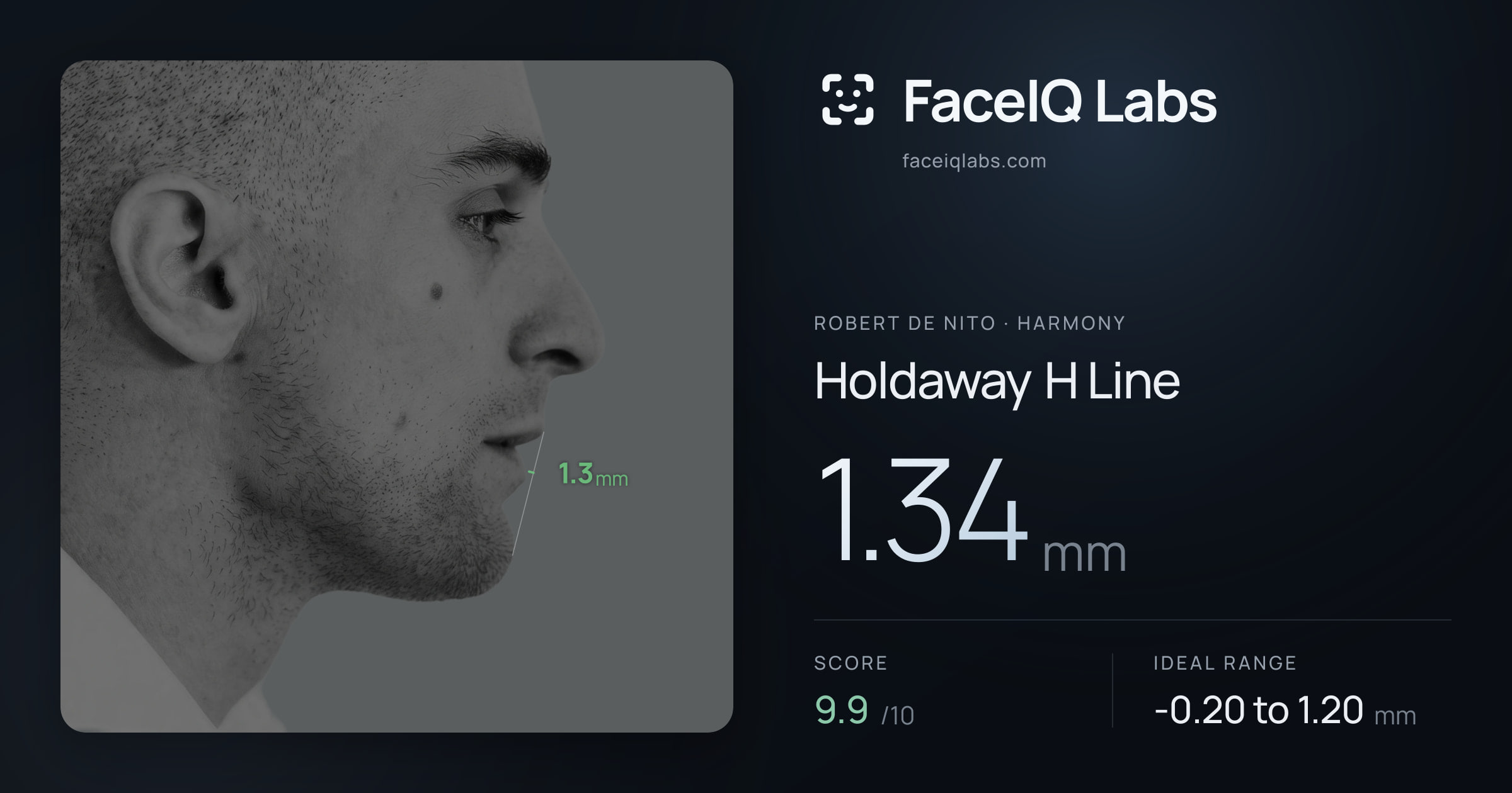 Robert De Nito Holdaway H Line: 1.34mm, drawn on the photo