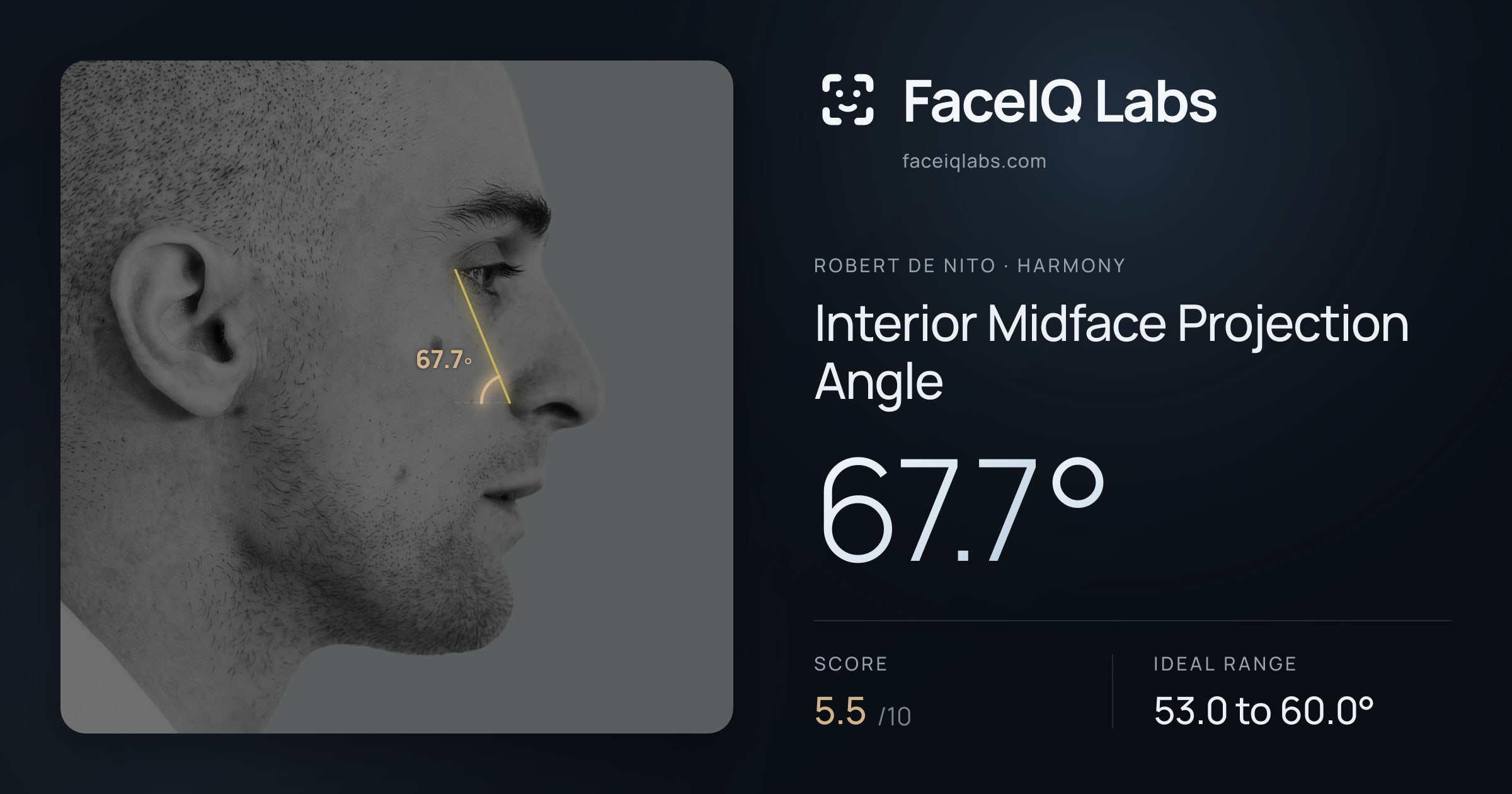 Robert De Nito Interior Midface Projection Angle: 67.7°, drawn on the photo