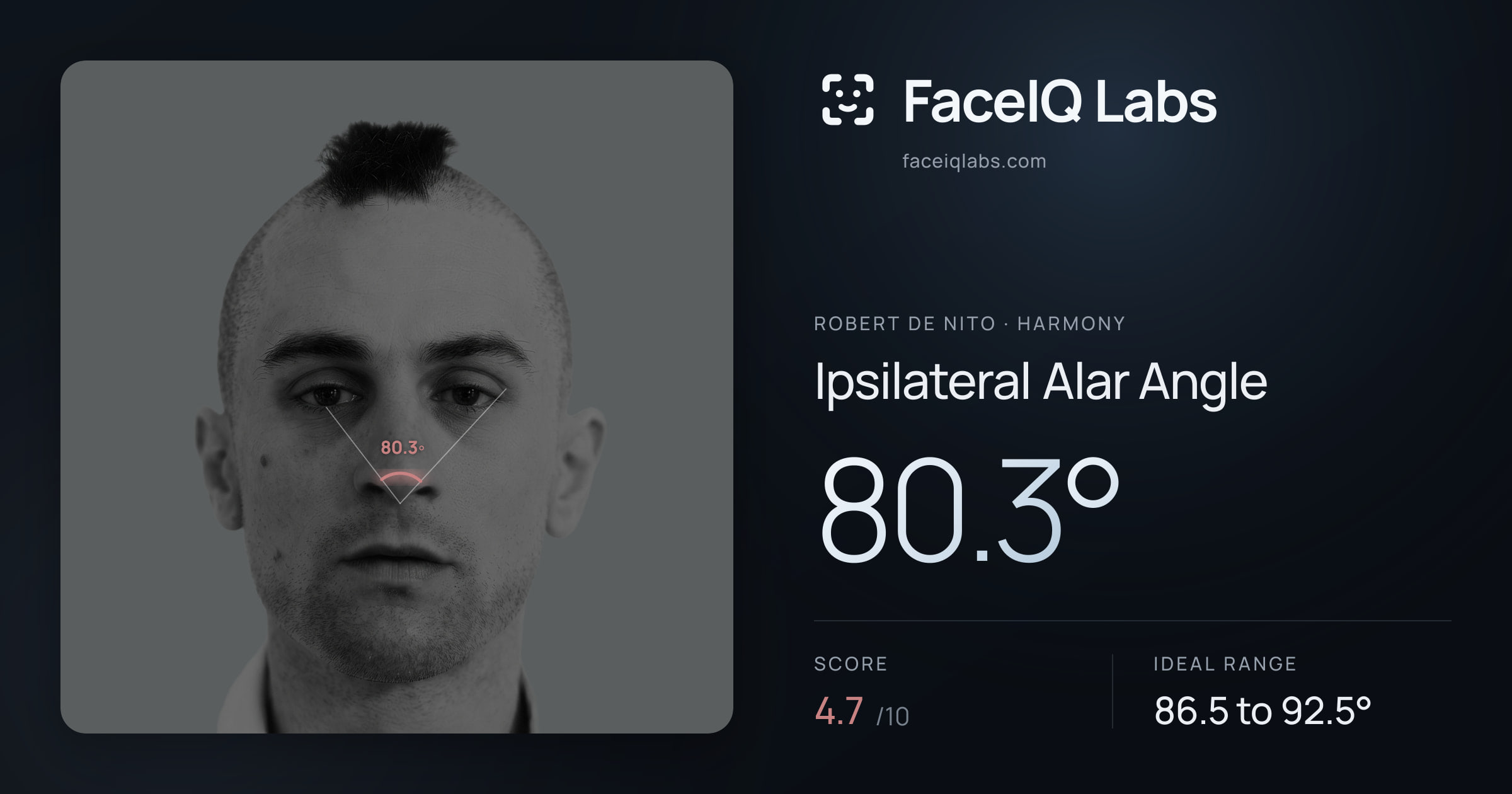 Robert De Nito Ipsilateral Alar Angle: 80.3°, drawn on the photo