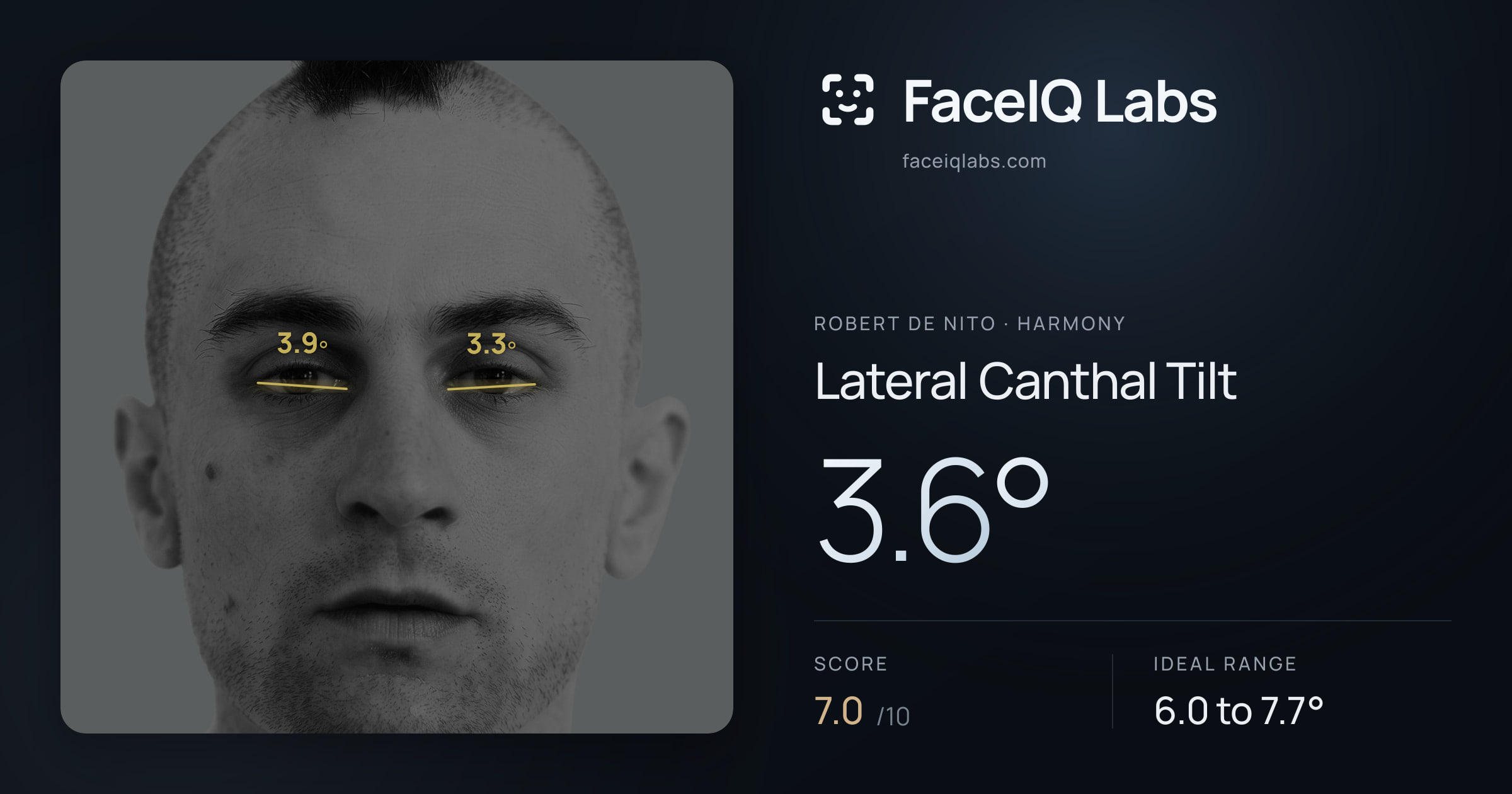 Robert De Nito Lateral Canthal Tilt: 3.6°, drawn on the photo