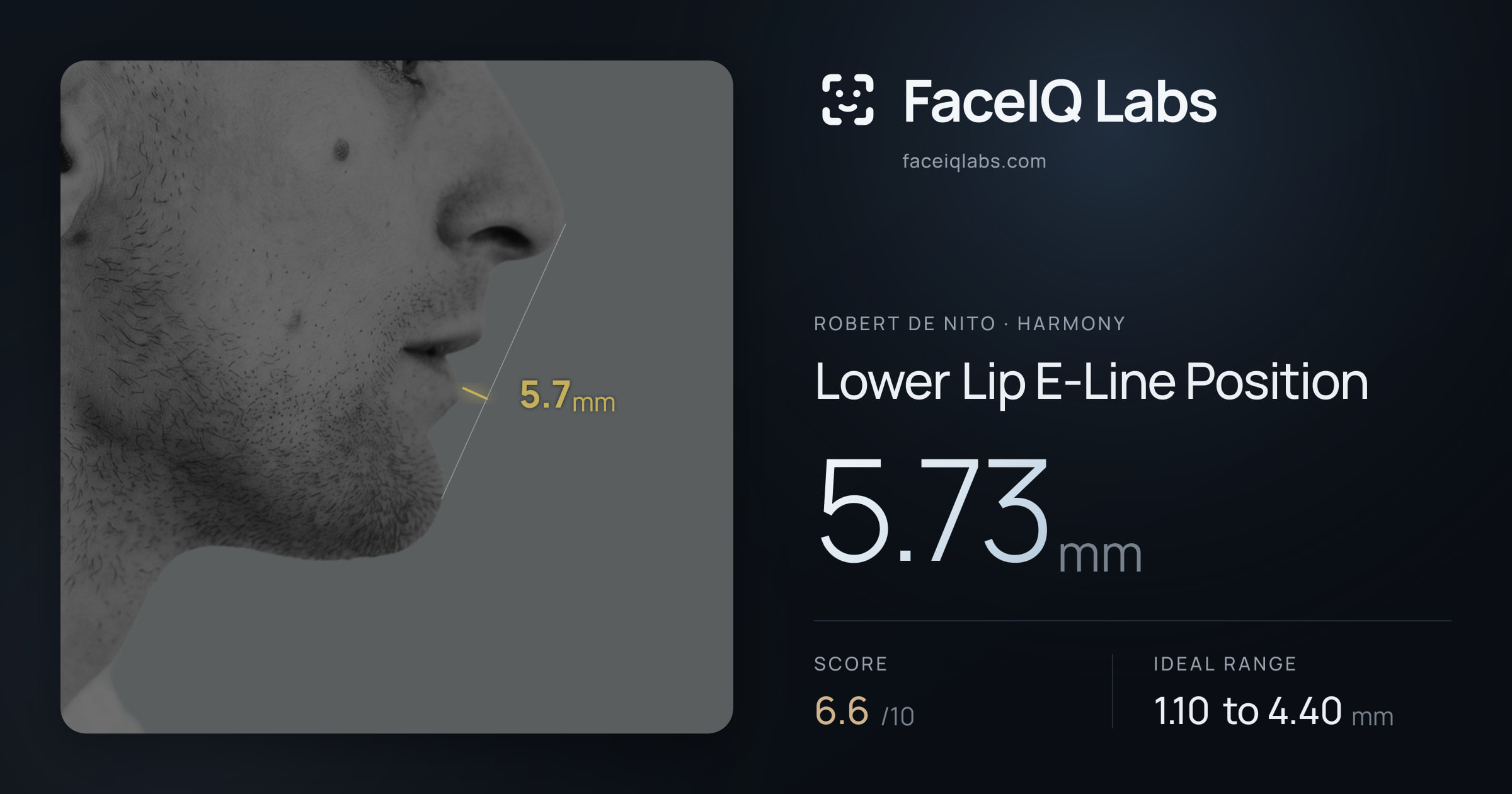 Robert De Nito Lower Lip E-Line Position: 5.73mm, drawn on the photo