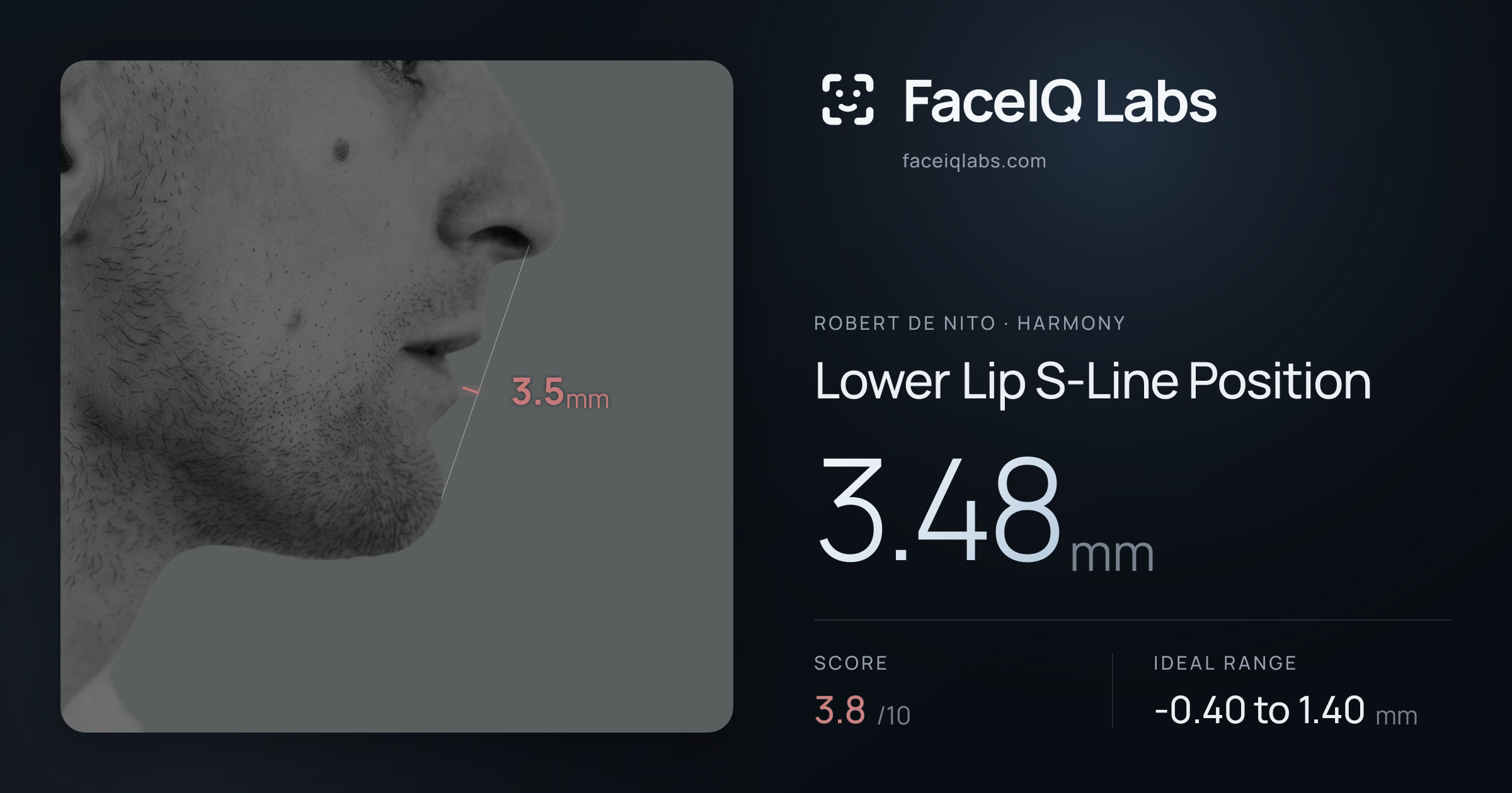 Robert De Nito Lower Lip S-Line Position: 3.48mm, drawn on the photo