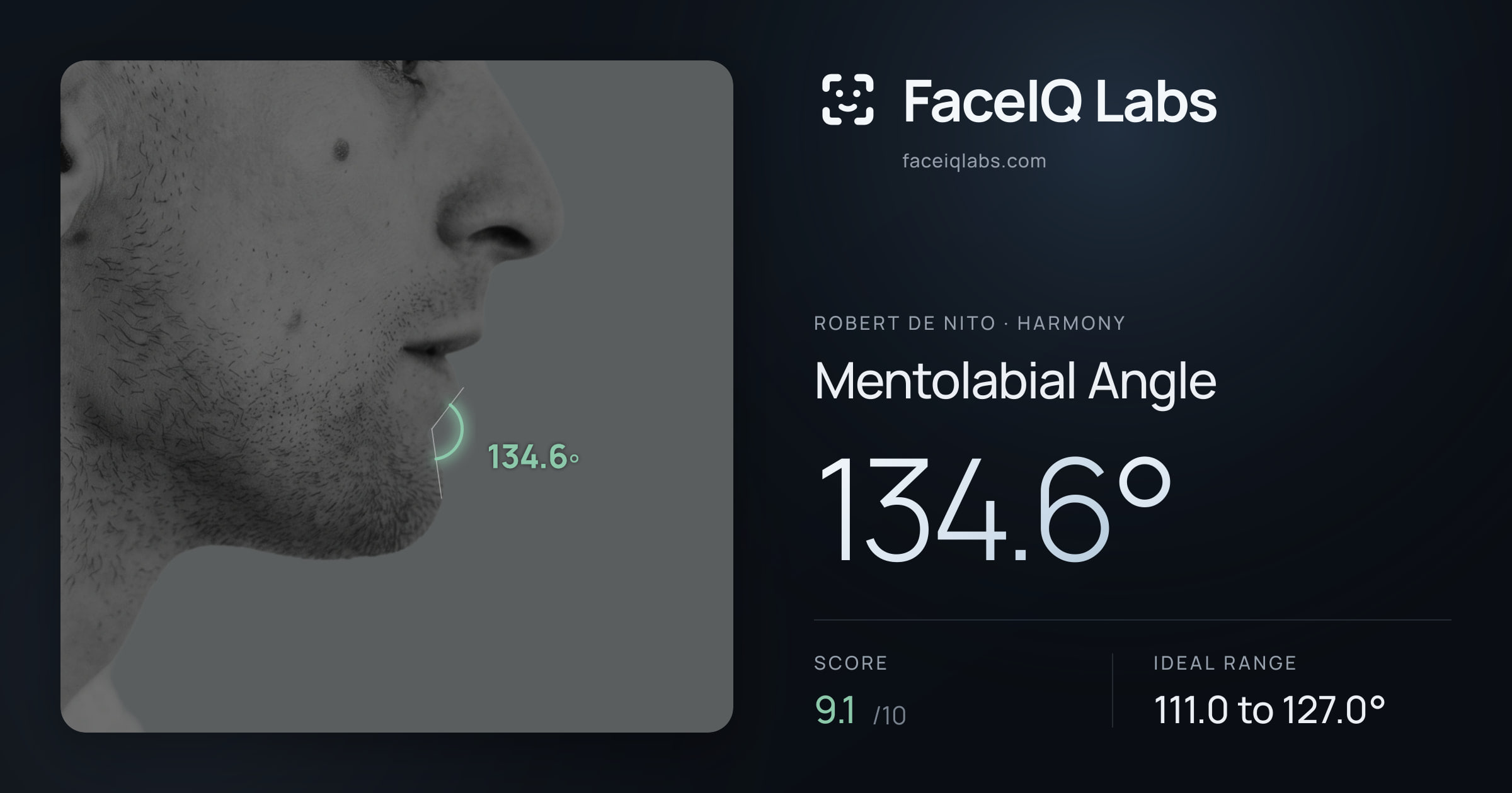 Robert De Nito Mentolabial Angle: 134.6°, drawn on the photo