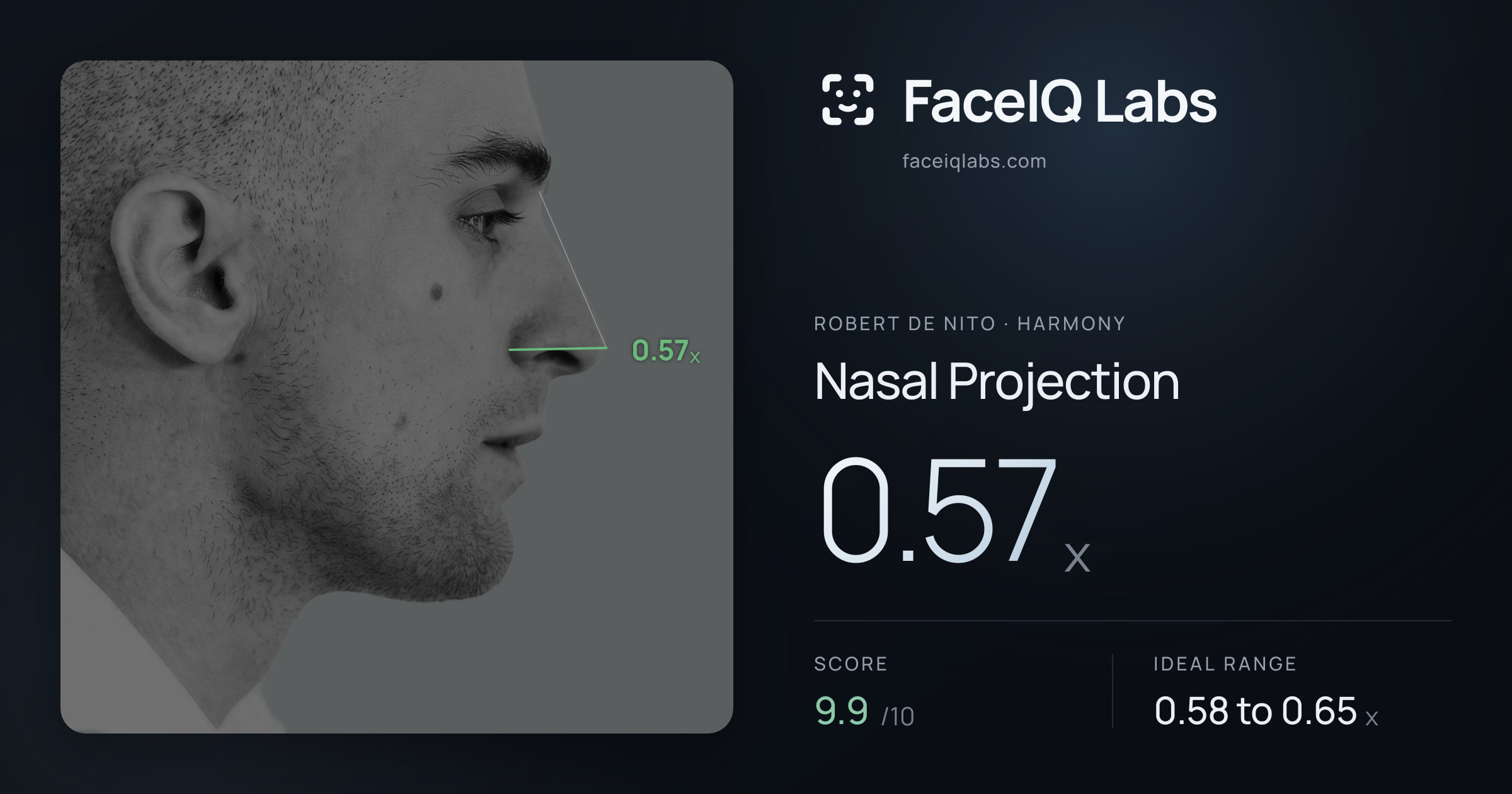 Robert De Nito Nasal Projection: 0.57x, drawn on the photo