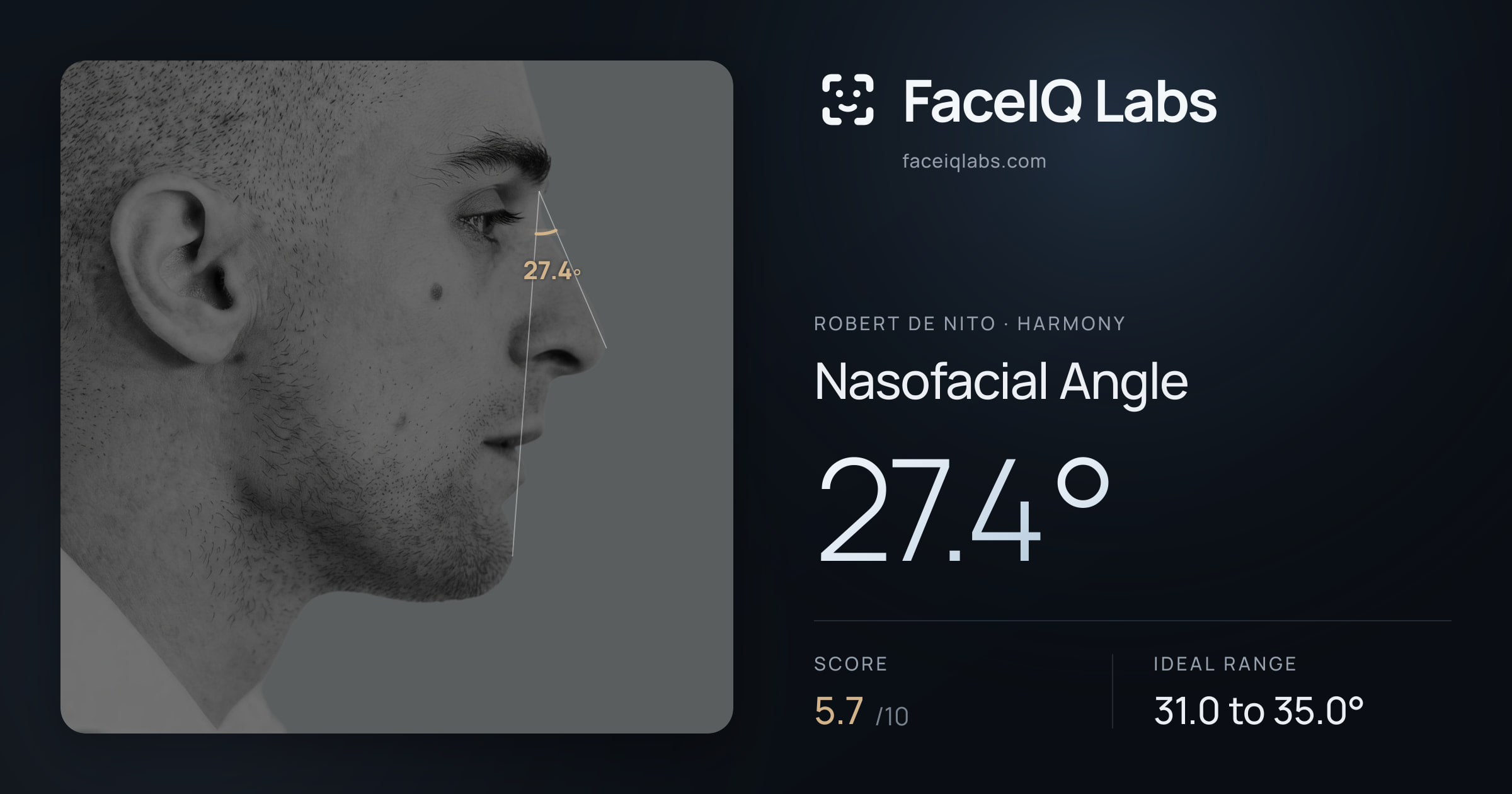 Robert De Nito Nasofacial Angle: 27.4°, drawn on the photo