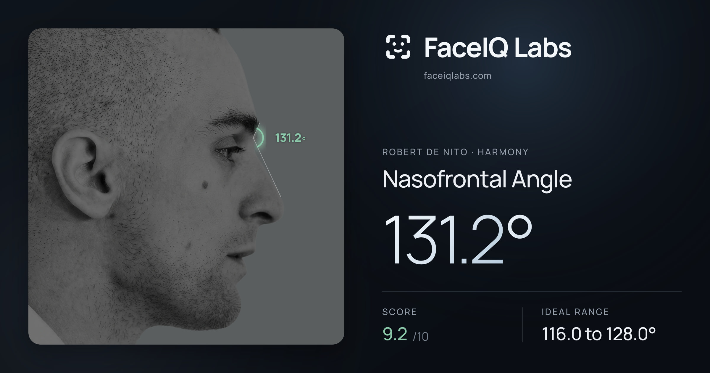 Robert De Nito Nasofrontal Angle: 131.2°, drawn on the photo