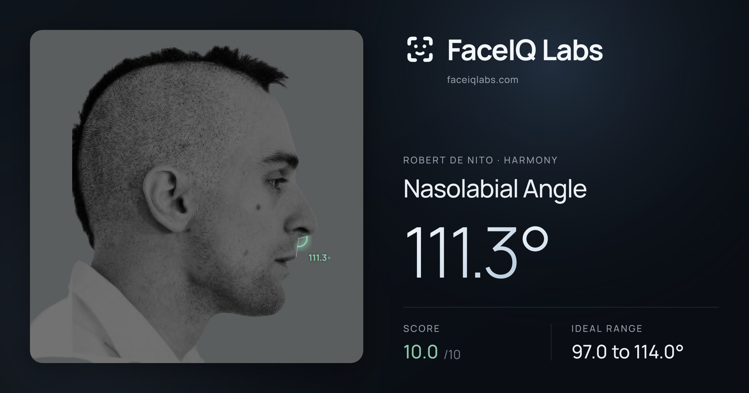 Robert De Nito Nasolabial Angle: 111.3°, drawn on the photo