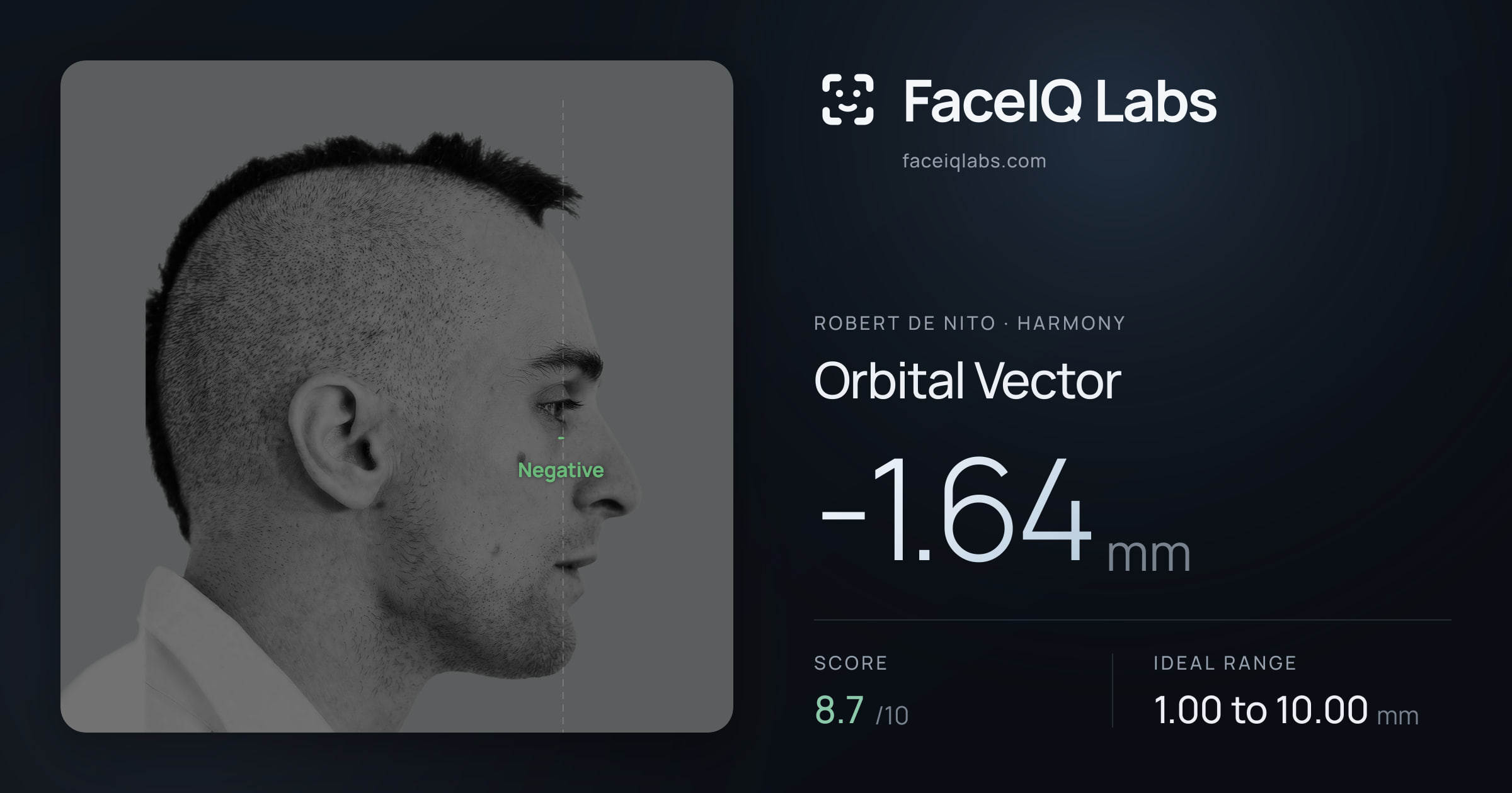 Robert De Nito Orbital Vector: -1.64mm, drawn on the photo