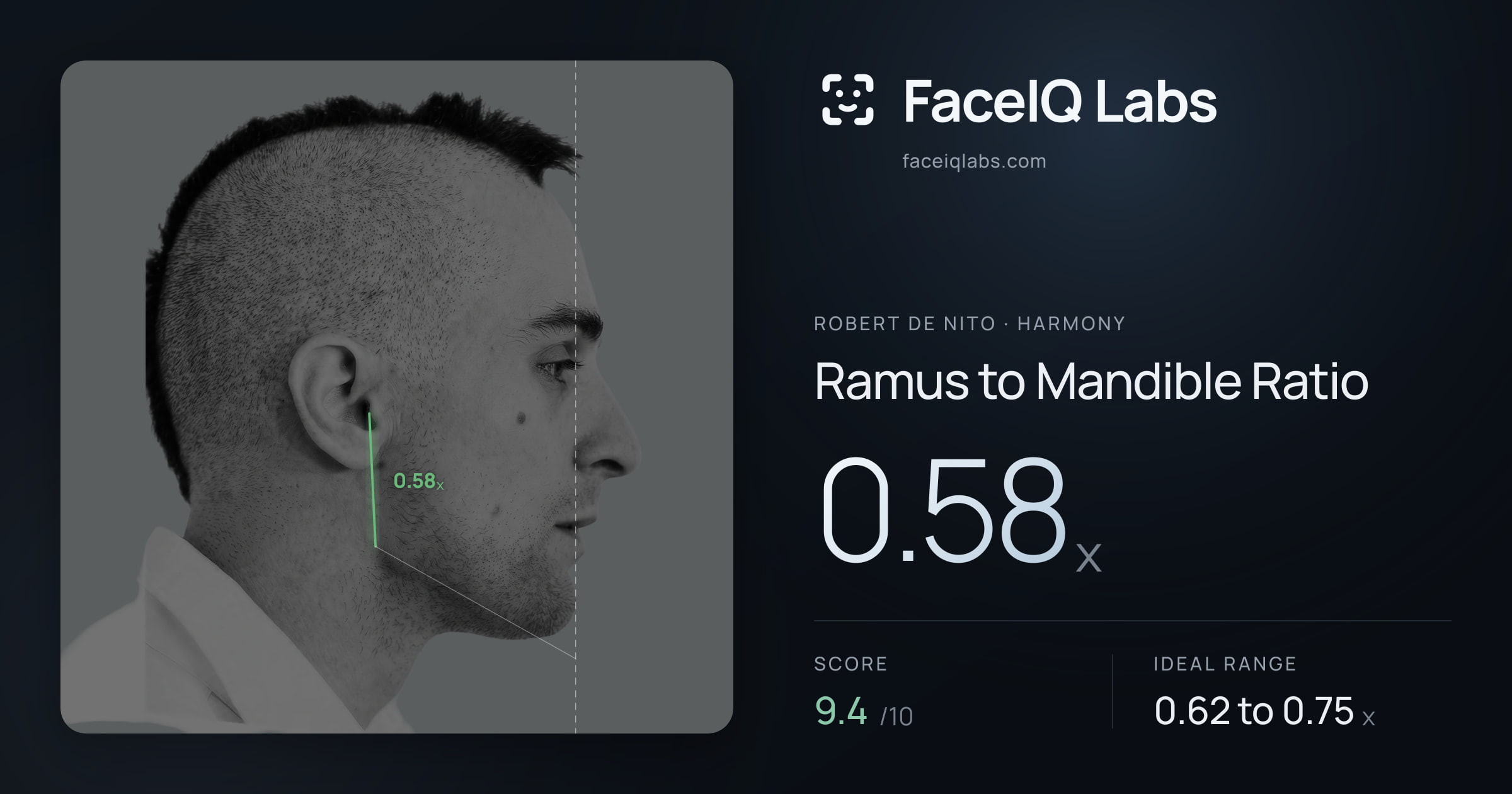 Robert De Nito Ramus to Mandible Ratio: 0.58x, drawn on the photo