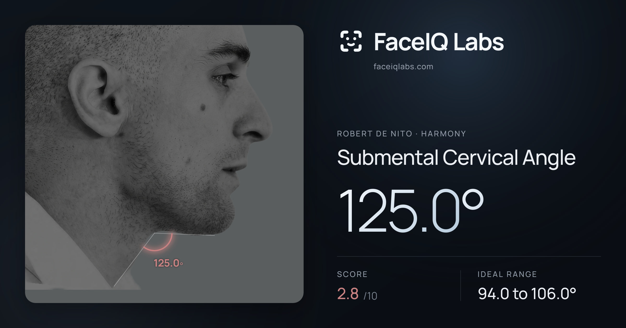 Robert De Nito Submental Cervical Angle: 125.0°, drawn on the photo
