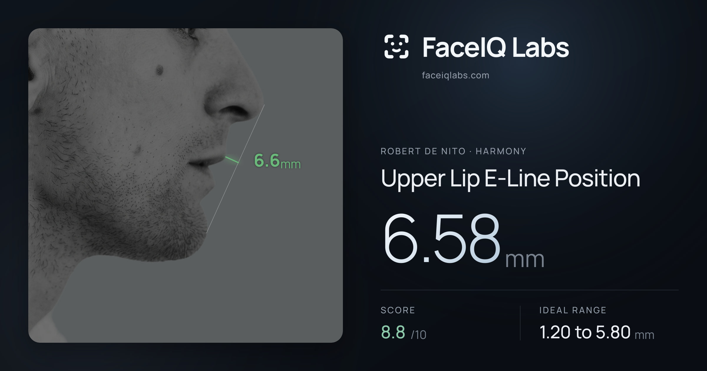 Robert De Nito Upper Lip E-Line Position: 6.58mm, drawn on the photo