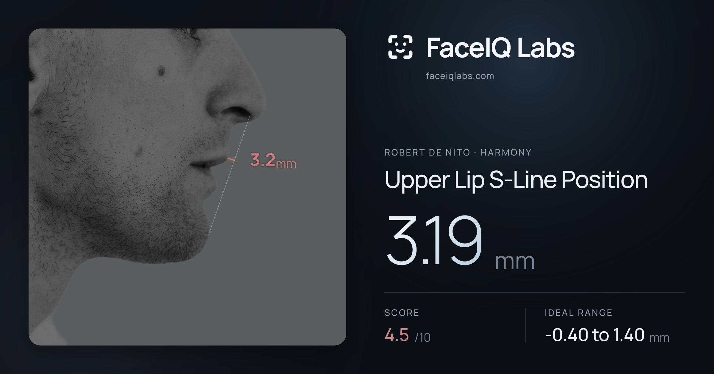 Robert De Nito Upper Lip S-Line Position: 3.19mm, drawn on the photo