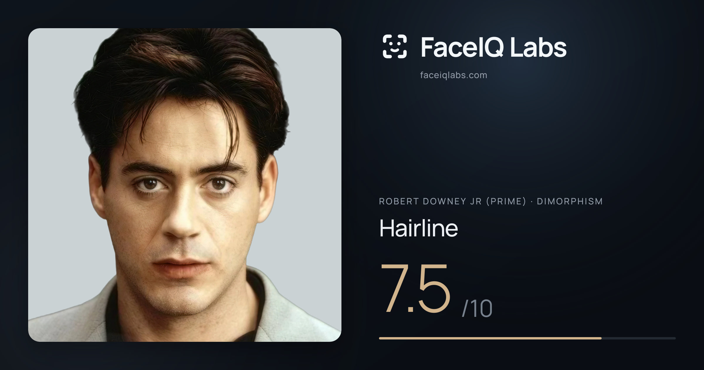 Robert Downey Jr (Prime) Hairline: 7.5/10, drawn on the photo