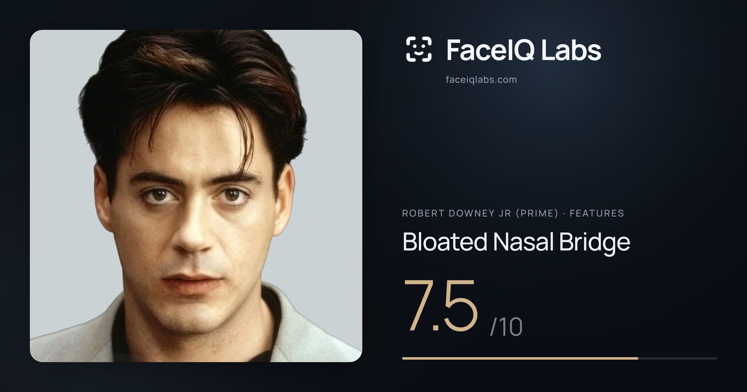 Robert Downey Jr (Prime) Bloated Nasal Bridge: 7.5/10, drawn on the photo