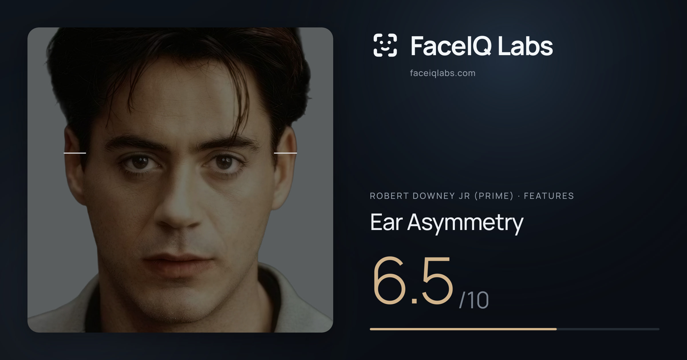 Robert Downey Jr (Prime) Ear Asymmetry: 6.5/10, drawn on the photo