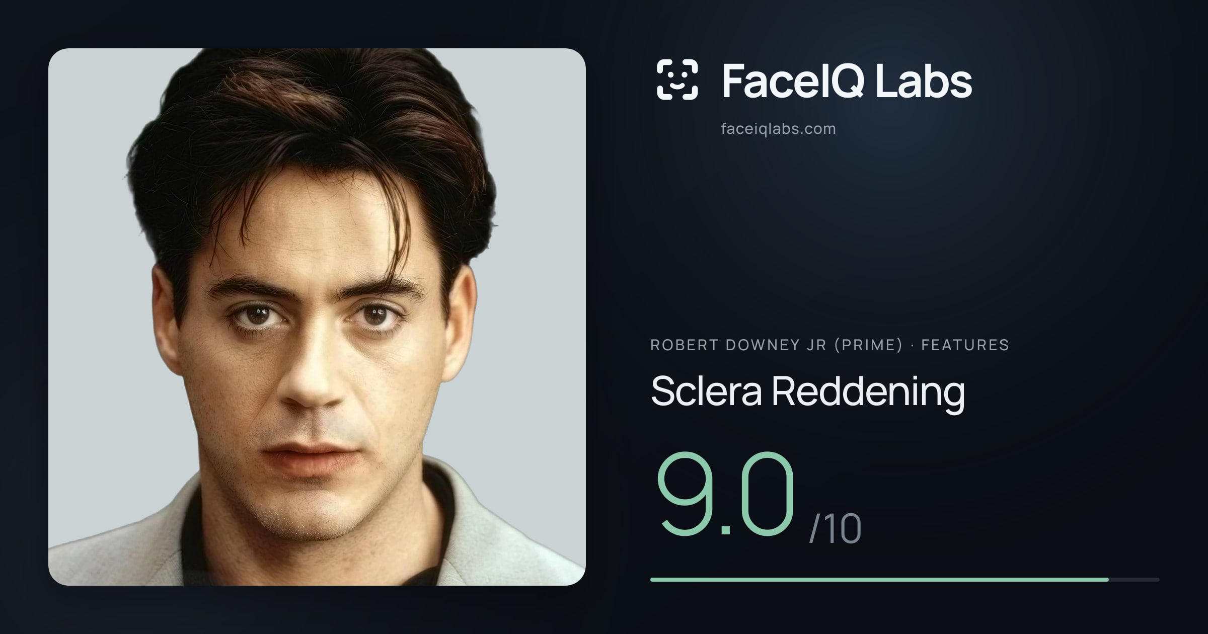 Robert Downey Jr (Prime) Sclera Reddening: 9.0/10, drawn on the photo