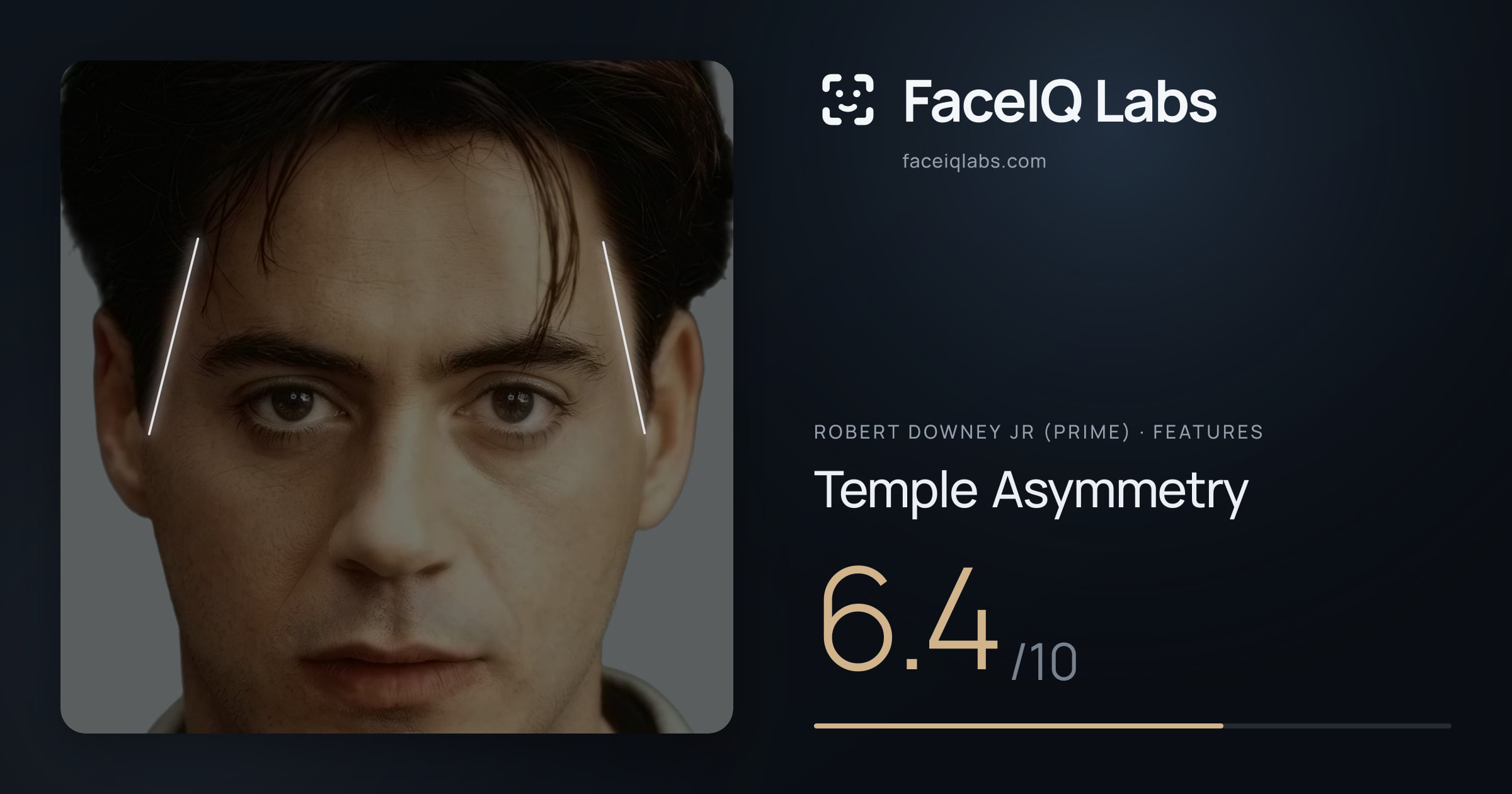 Robert Downey Jr (Prime) Temple Asymmetry: 6.4/10, drawn on the photo