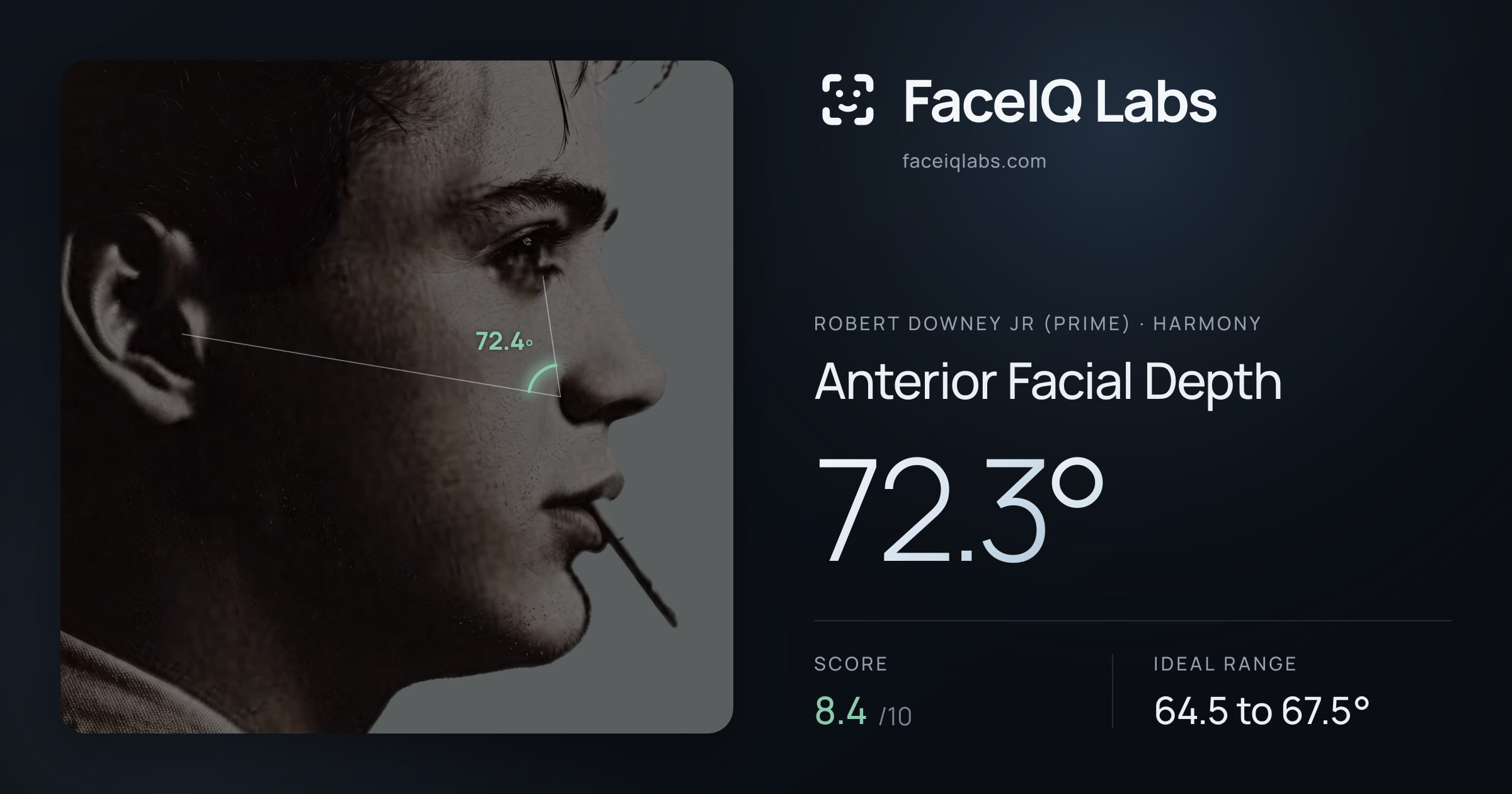 Robert Downey Jr (Prime) Anterior Facial Depth: 72.3°, drawn on the photo