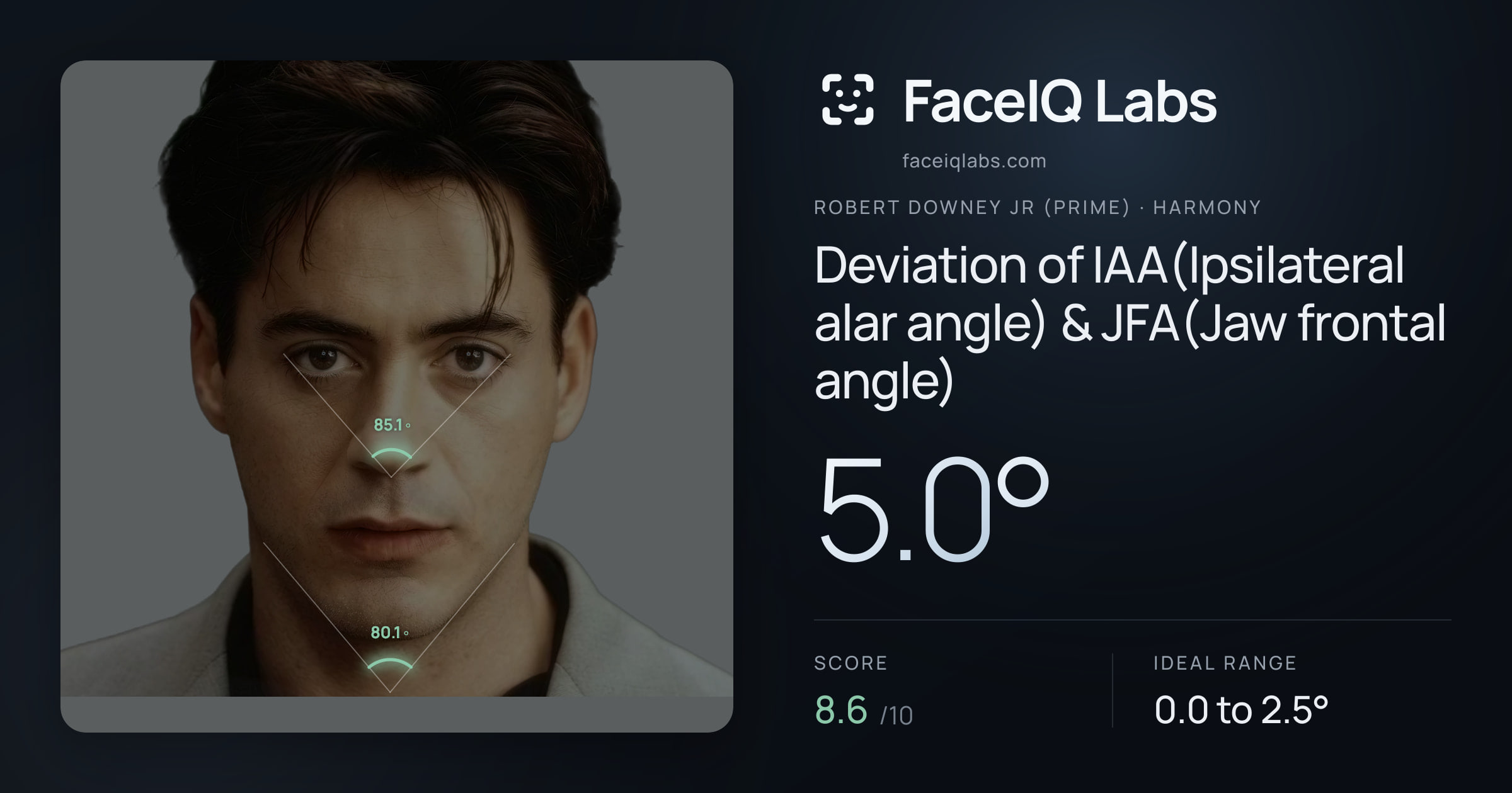 Robert Downey Jr (Prime) Deviation of IAA(Ipsilateral alar angle) & JFA(Jaw frontal angle): 5.0°, drawn on the photo