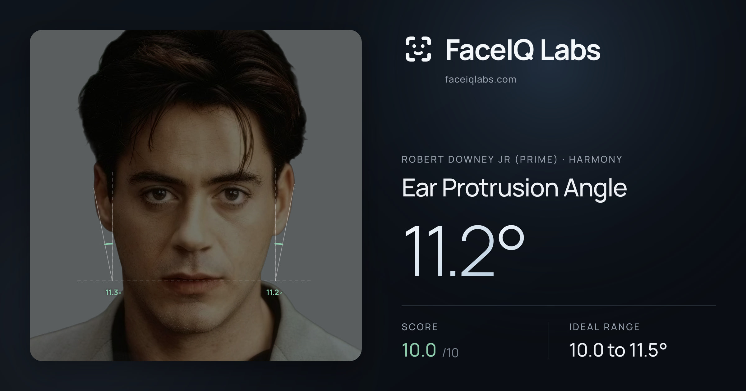 Robert Downey Jr (Prime) Ear Protrusion Angle: 11.2°, drawn on the photo