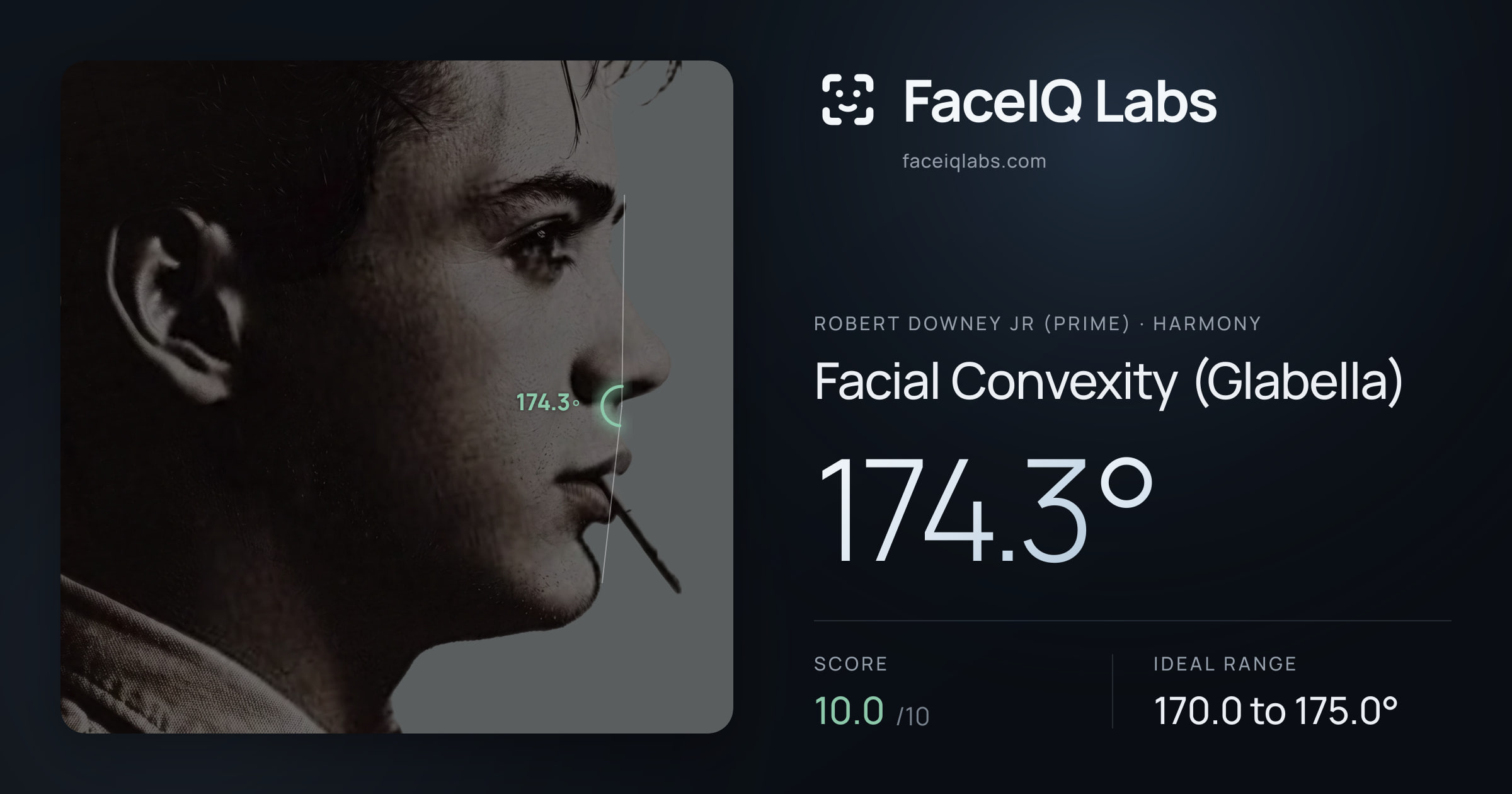 Robert Downey Jr (Prime) Facial Convexity (Glabella): 174.3°, drawn on the photo