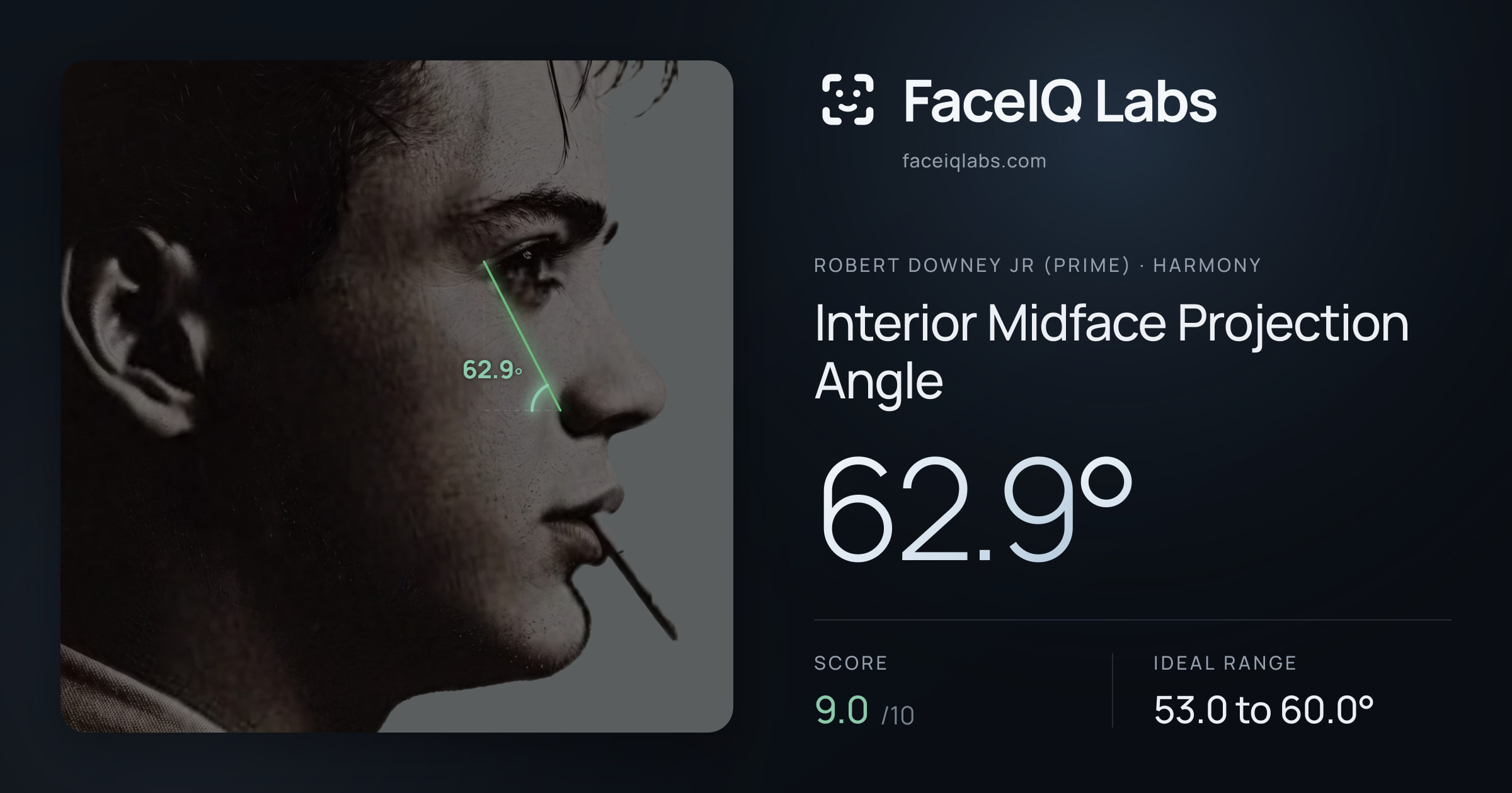 Robert Downey Jr (Prime) Interior Midface Projection Angle: 62.9°, drawn on the photo