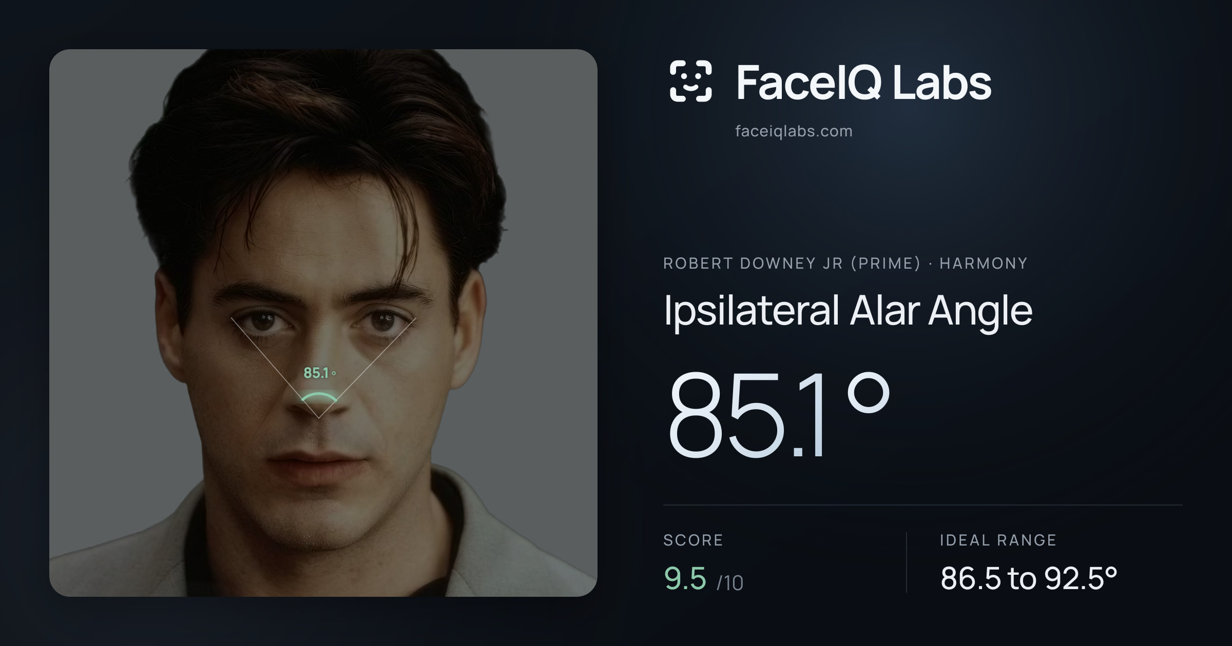 Robert Downey Jr (Prime) Ipsilateral Alar Angle: 85.1°, drawn on the photo