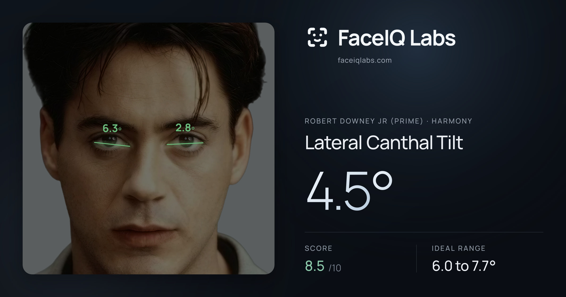 Robert Downey Jr (Prime) Lateral Canthal Tilt: 4.5°, drawn on the photo
