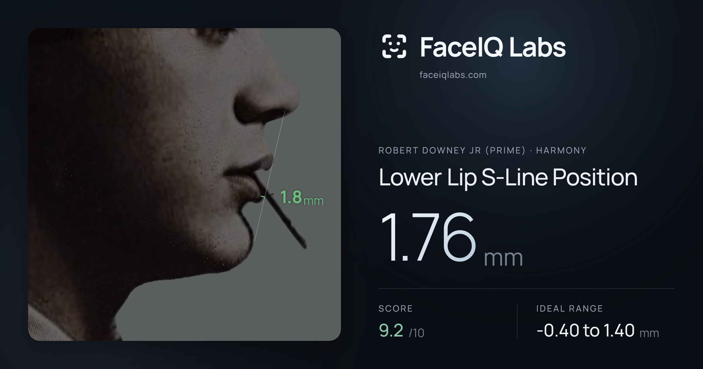 Robert Downey Jr (Prime) Lower Lip S-Line Position: 1.76mm, drawn on the photo