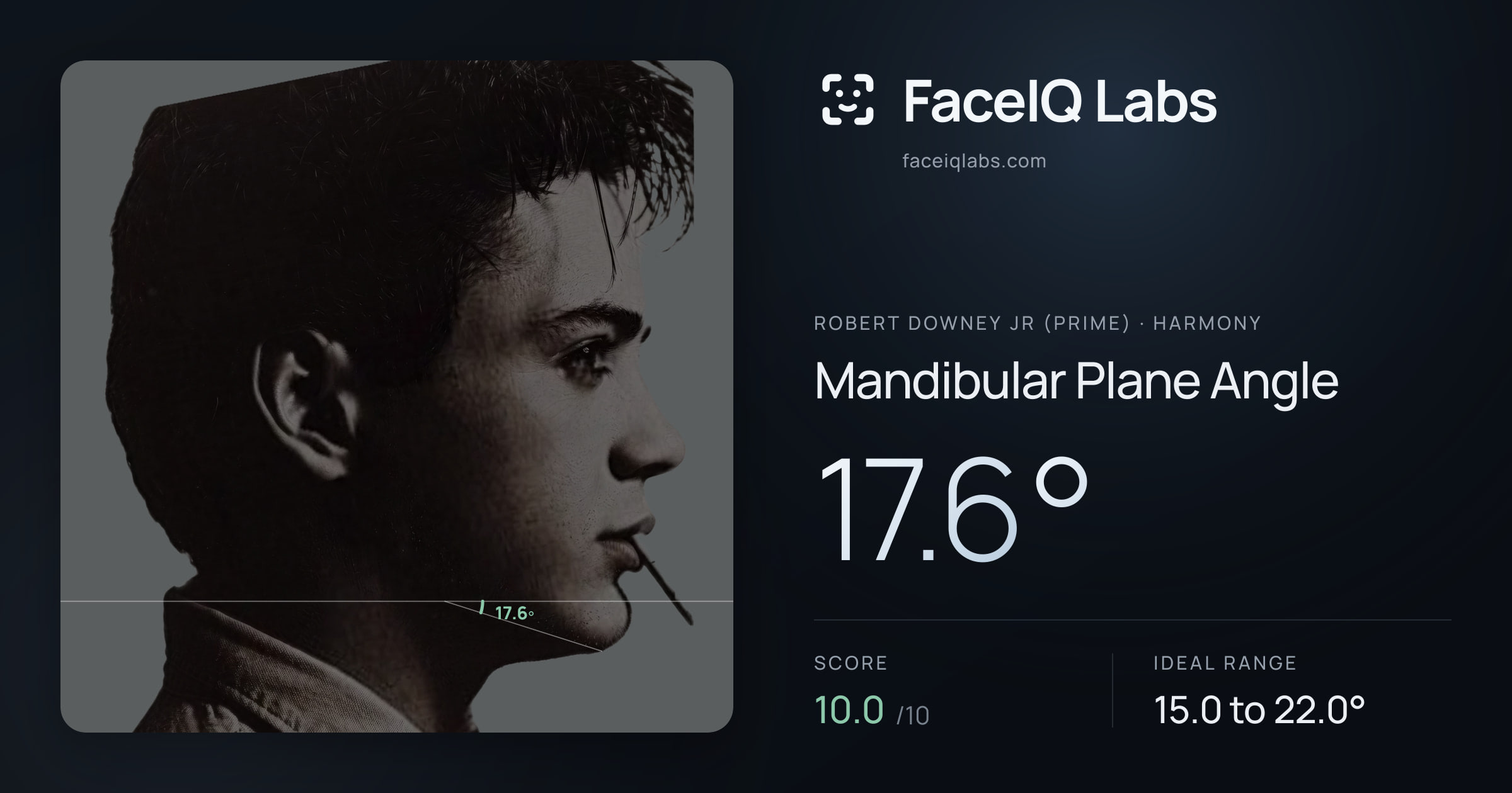 Robert Downey Jr (Prime) Mandibular Plane Angle: 17.6°, drawn on the photo