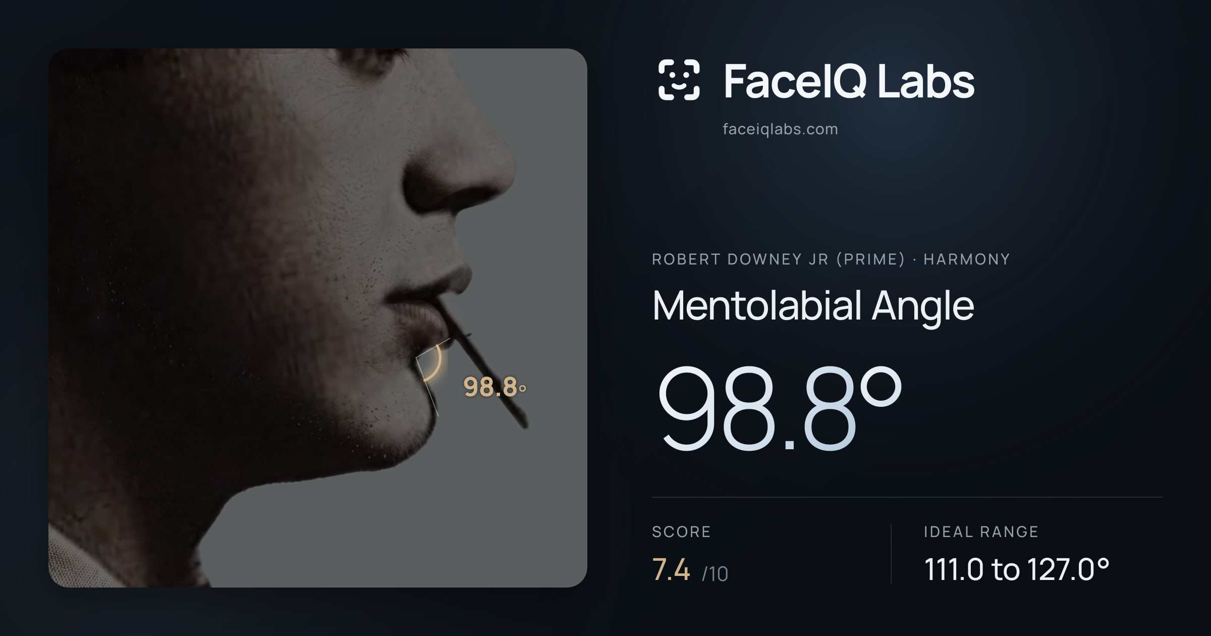 Robert Downey Jr (Prime) Mentolabial Angle: 98.8°, drawn on the photo