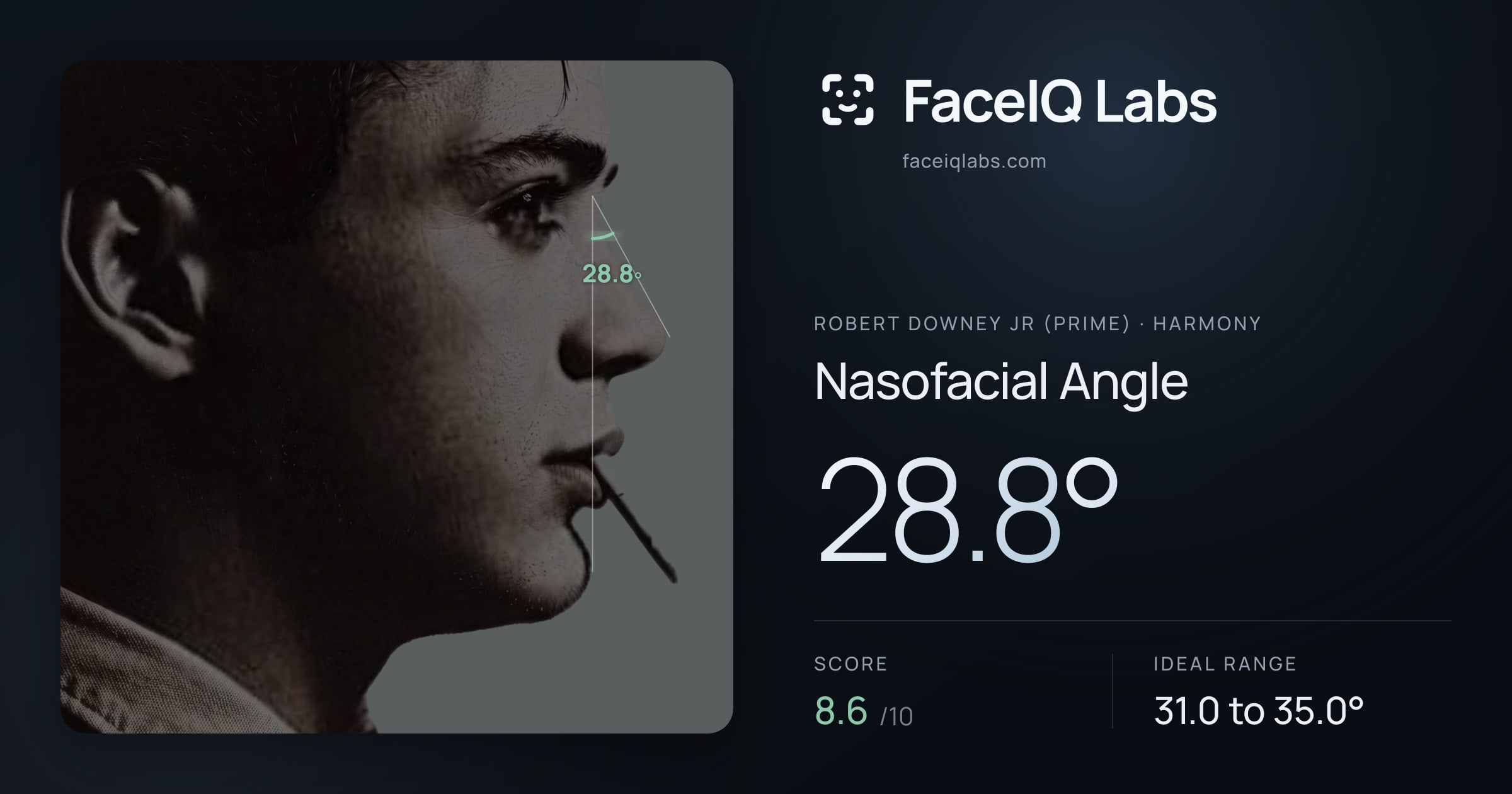 Robert Downey Jr (Prime) Nasofacial Angle: 28.8°, drawn on the photo