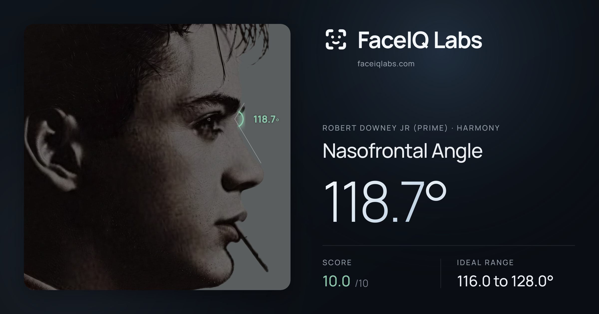 Robert Downey Jr (Prime) Nasofrontal Angle: 118.7°, drawn on the photo